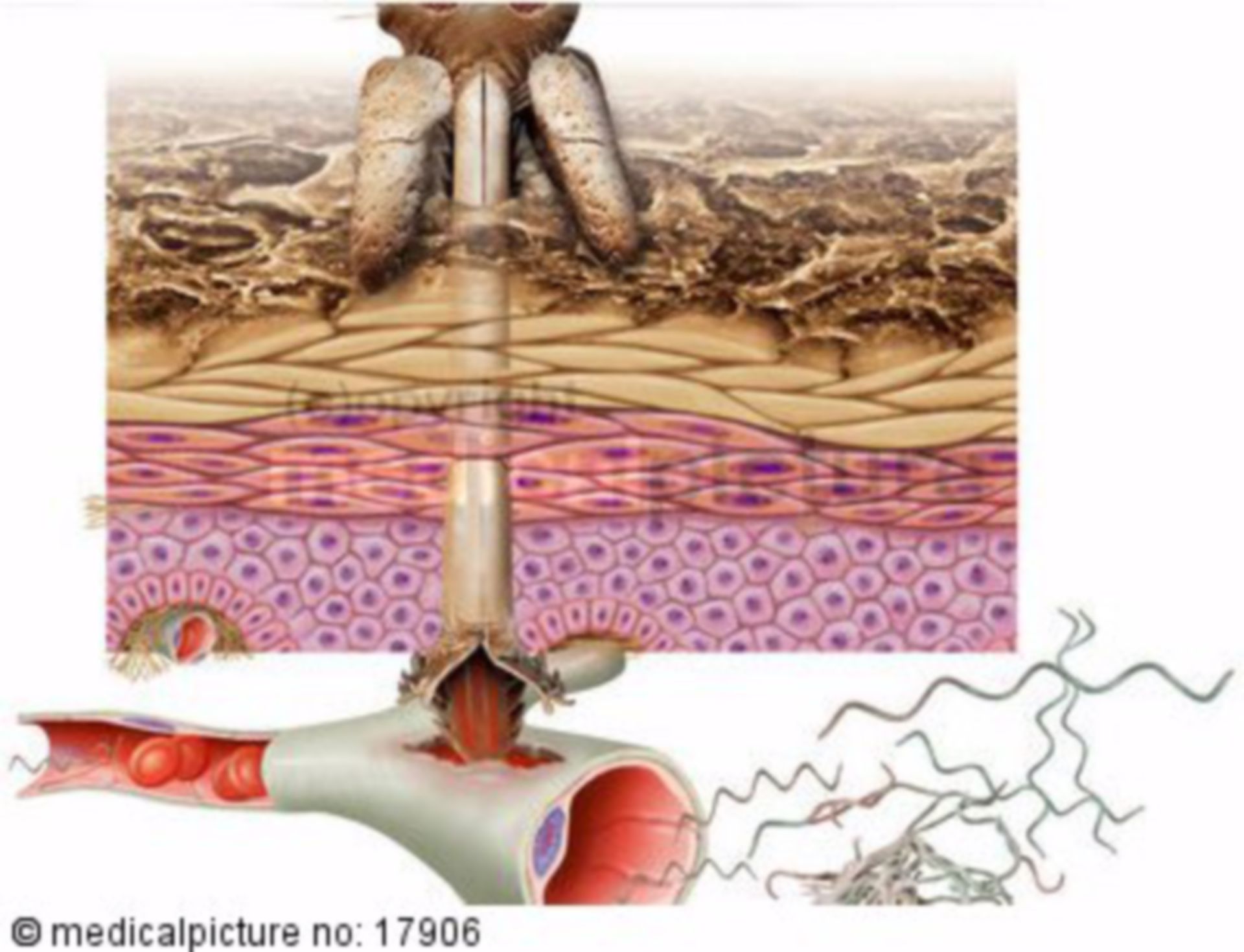 FSME Borreliose DocCheck FSME Borreliose DocCheck