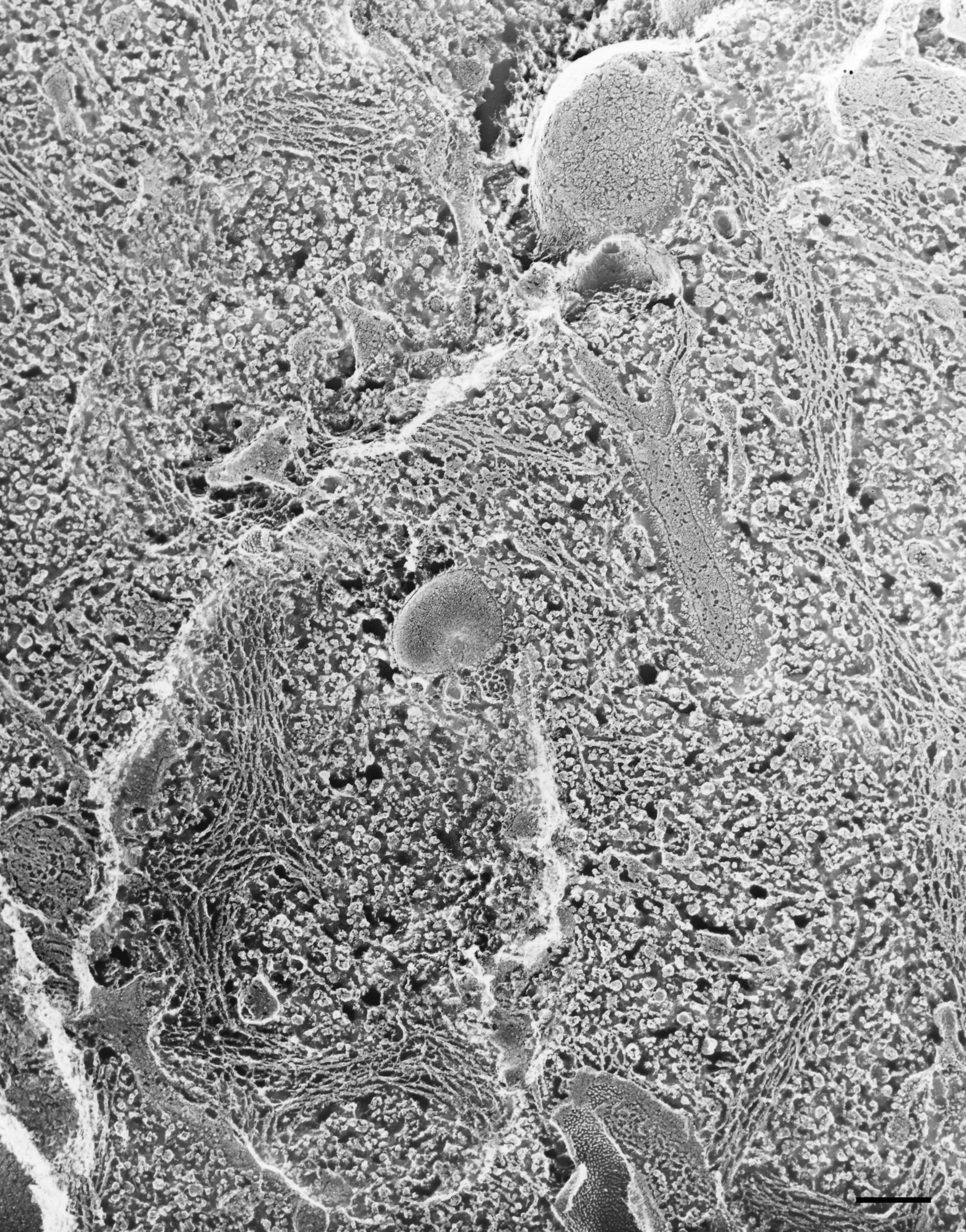 Paramecium multimicronucleatum (Early endosome) - CIL:21606 - DocCheck