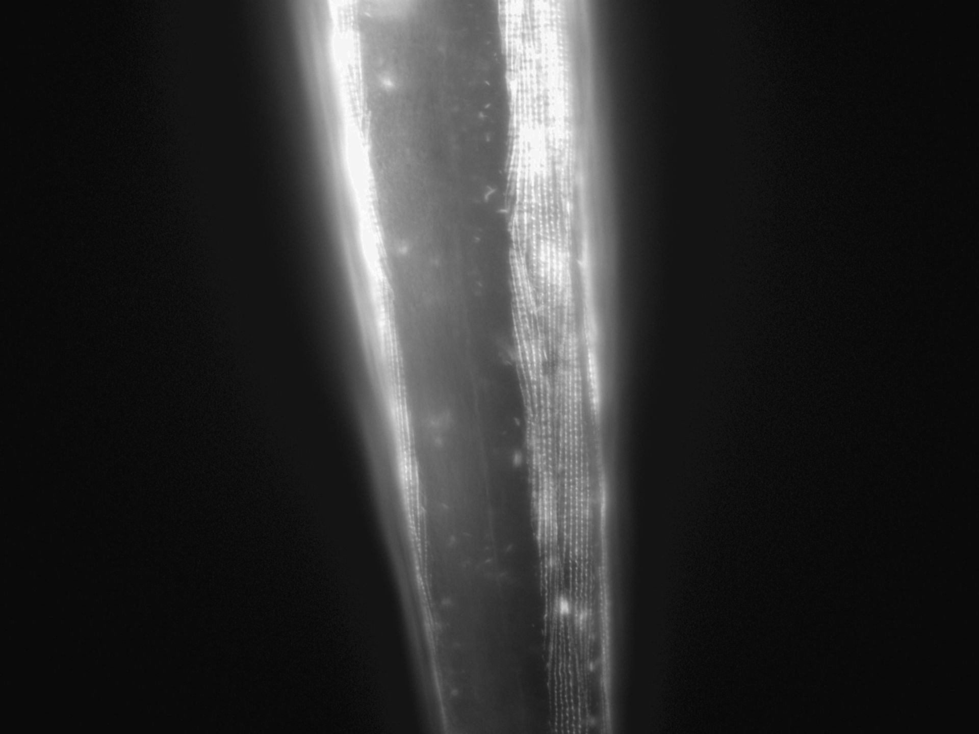 Caenorhabditis elegans (Actin filament) - CIL:1035