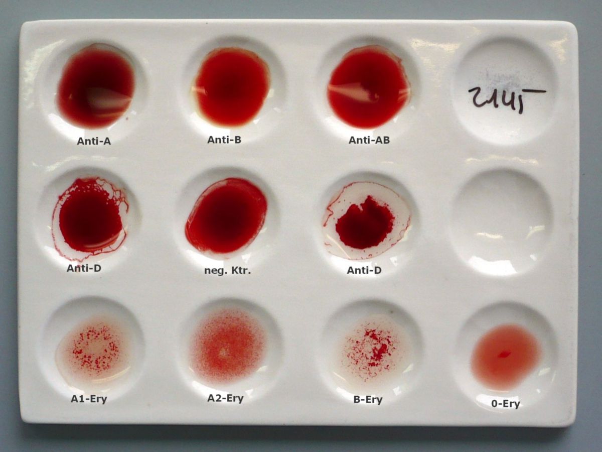 Какого размера кровь. Тарелка для определения группы крови. Чашка для определения группы крови. Определение группы крови фото. Цвета групп крови.