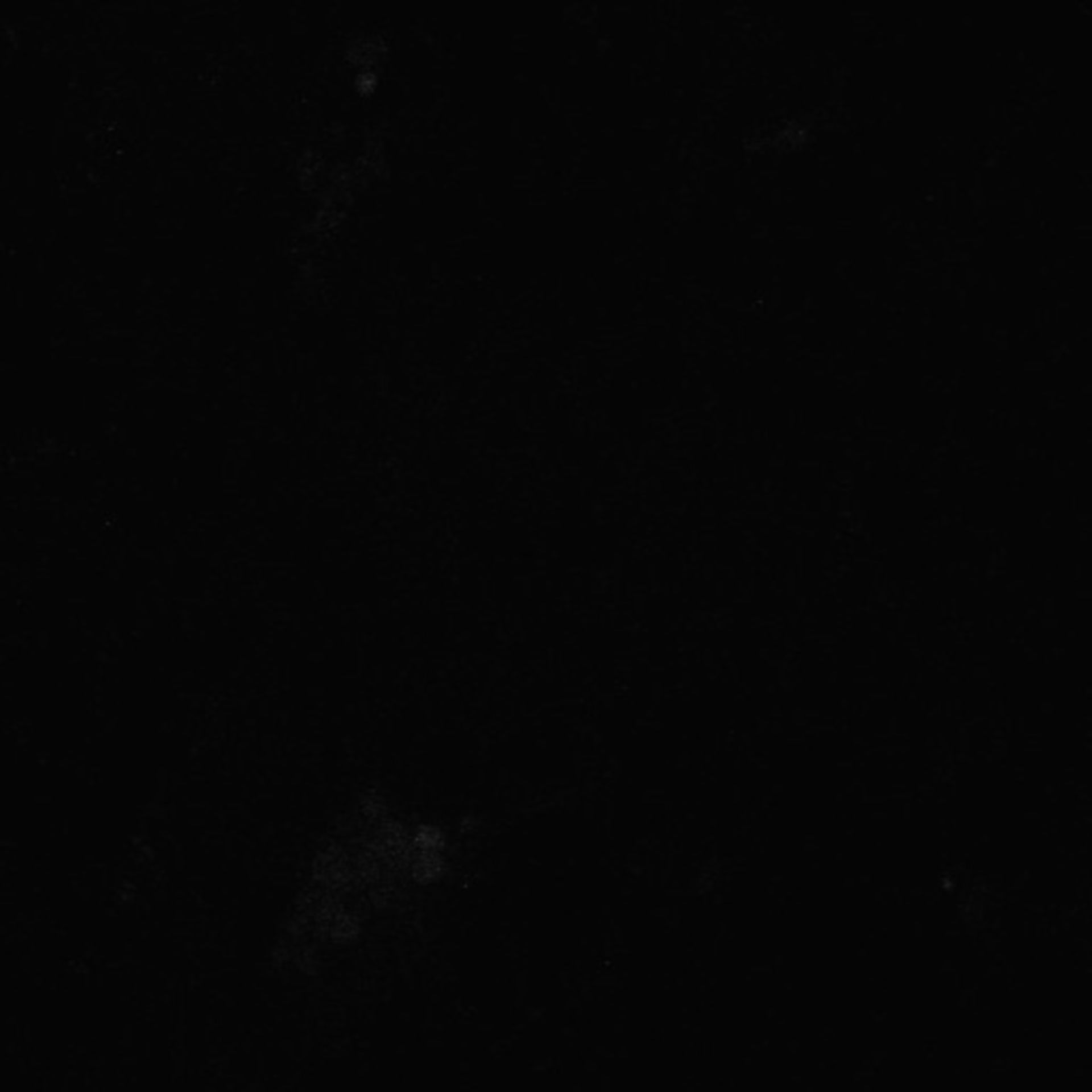 Xenopus laevis (Axon) - CIL:36979