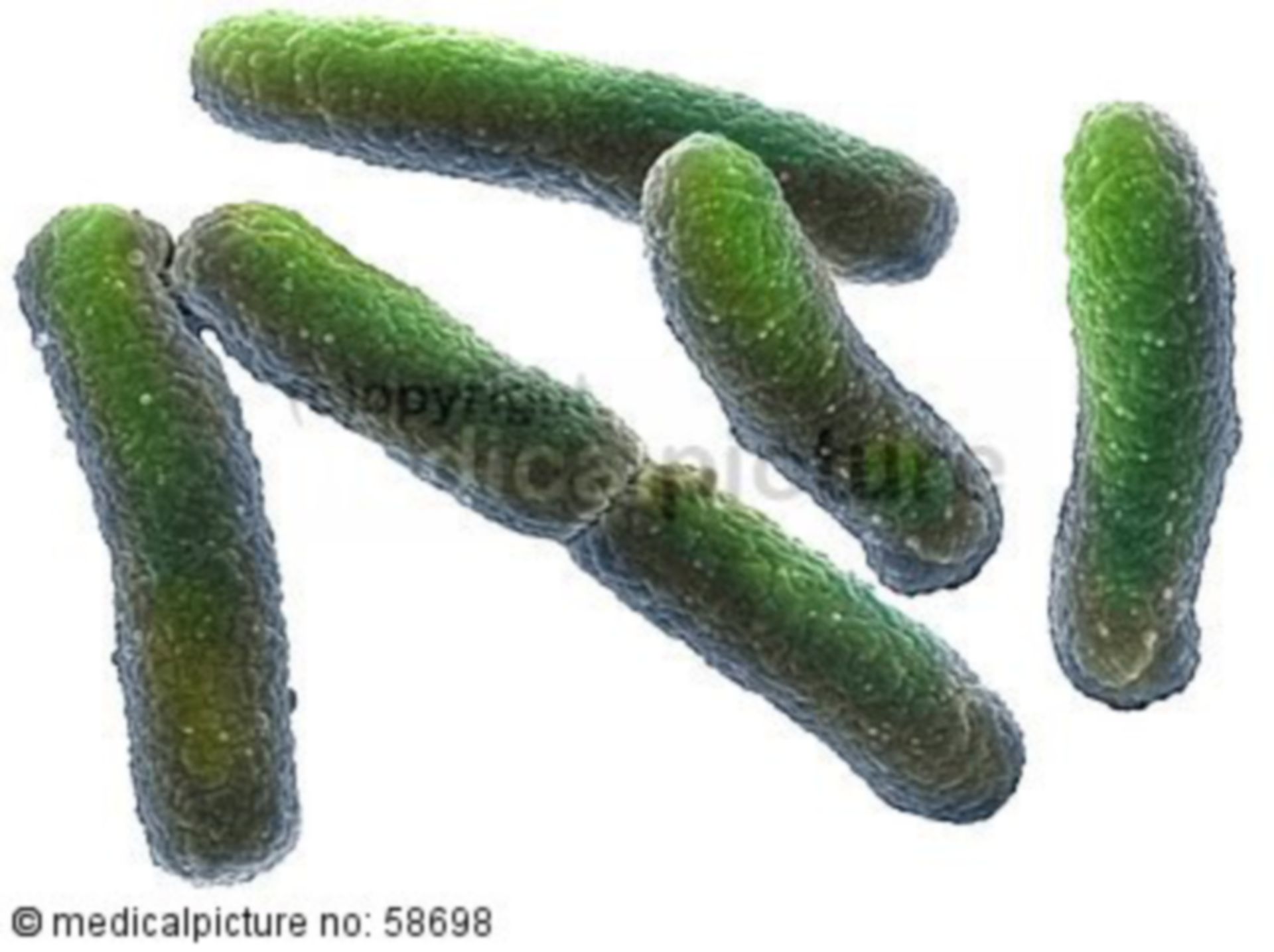 NDM 1 bacterium