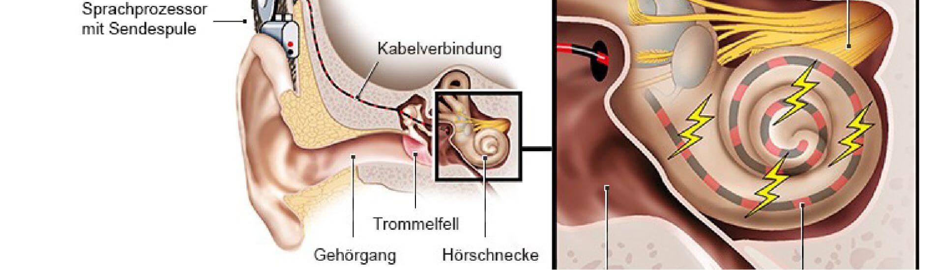 Kein Ton? Mehr Bild! Infos zur Schwerhörigkeit DocCheck