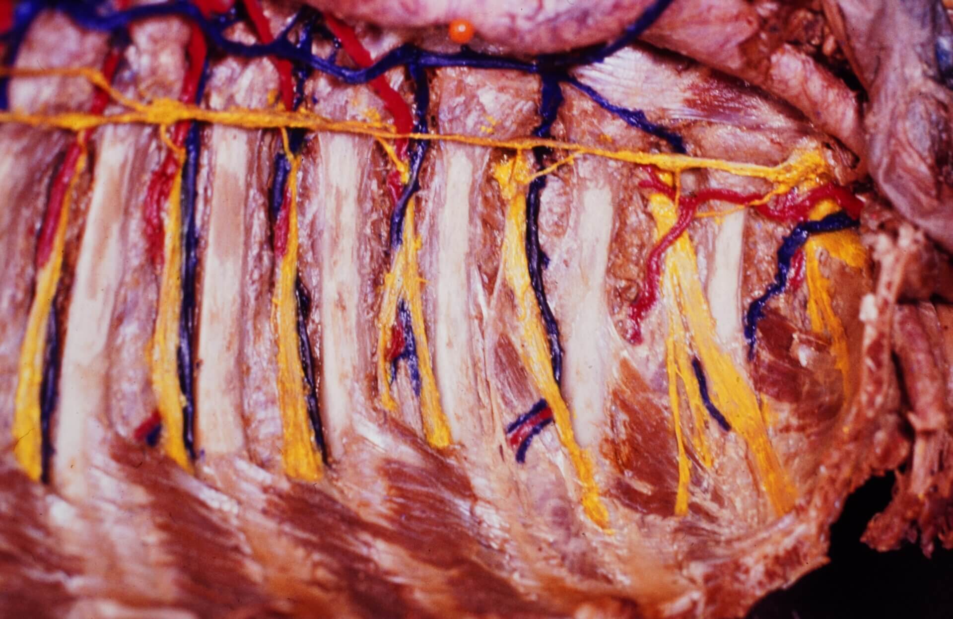 Thorax mit Aa. Vv. und Nn. intercostales