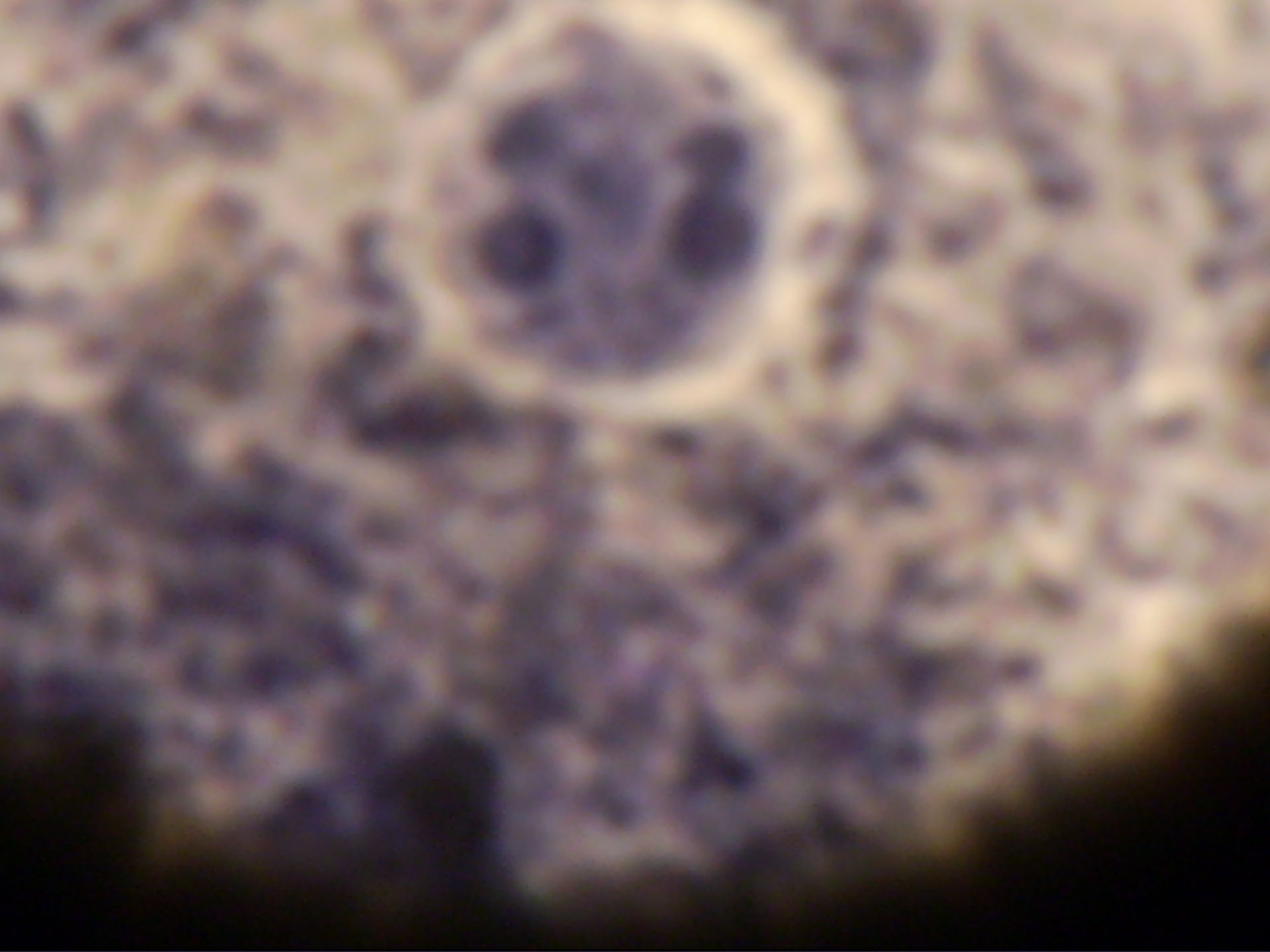 Mikroskopische Aufnahme der humanpathogenen Amöbenart Entamoeba histologica
