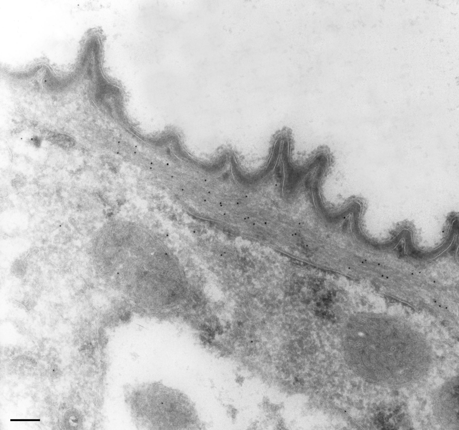 Vorticella convallaria (Myofibril) - CIL:36285