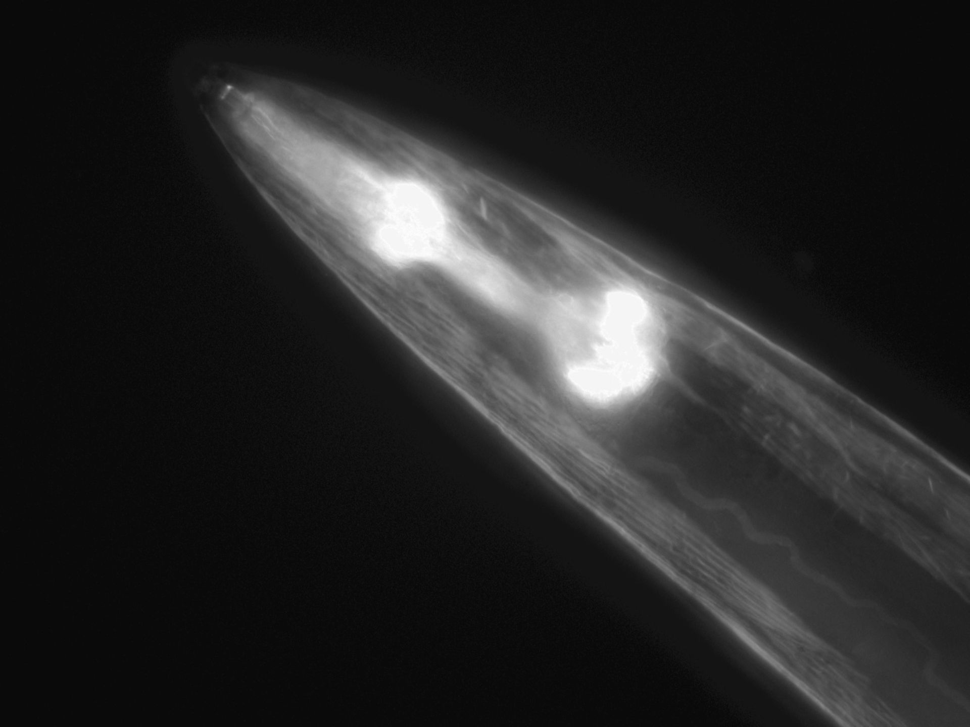 Caenorhabditis elegans (Actin filament) - CIL:1289