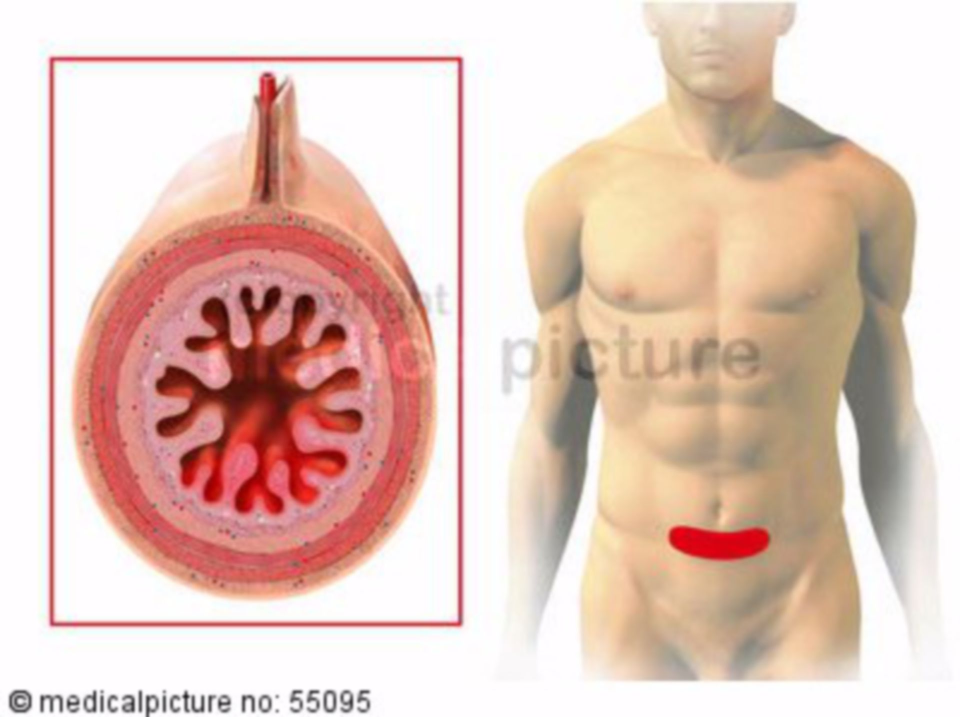 Small intestine: zones of referred pain