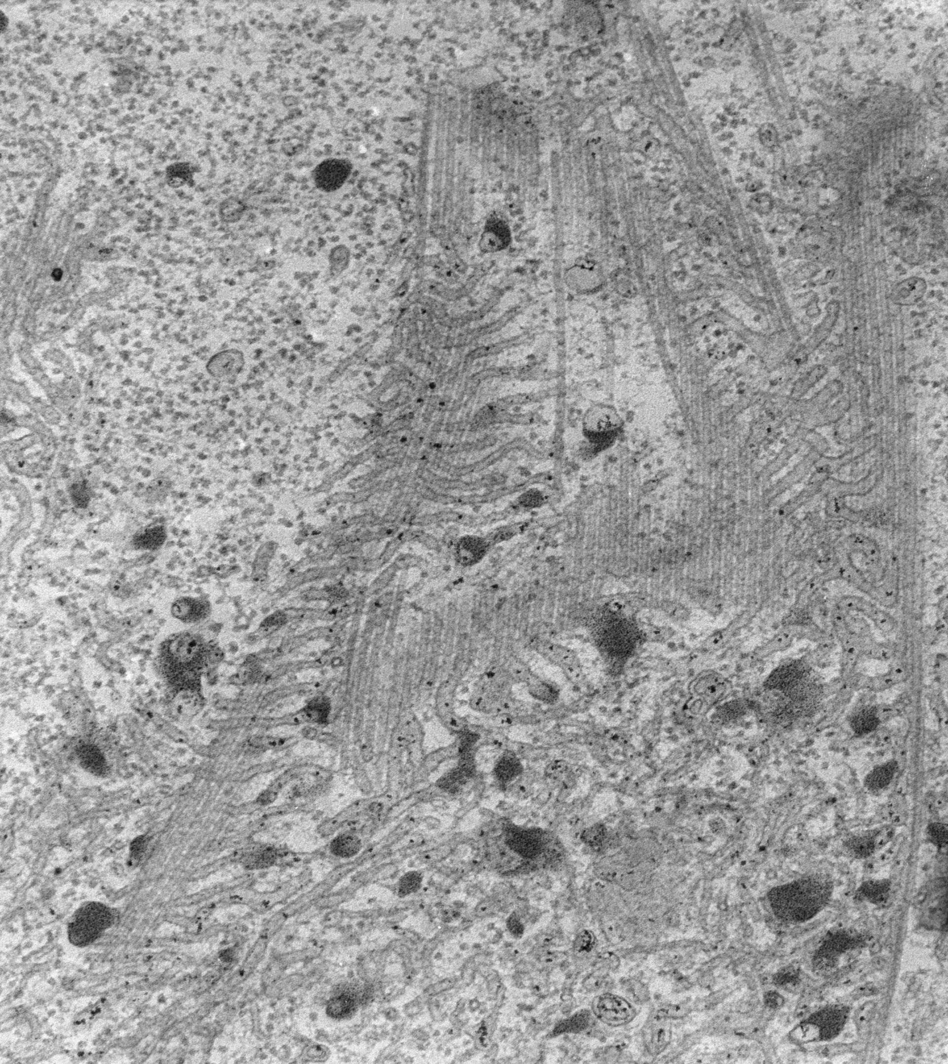 Paramecium multimicronucleatum (microtubuli citoplasmatici) - CIL:13115