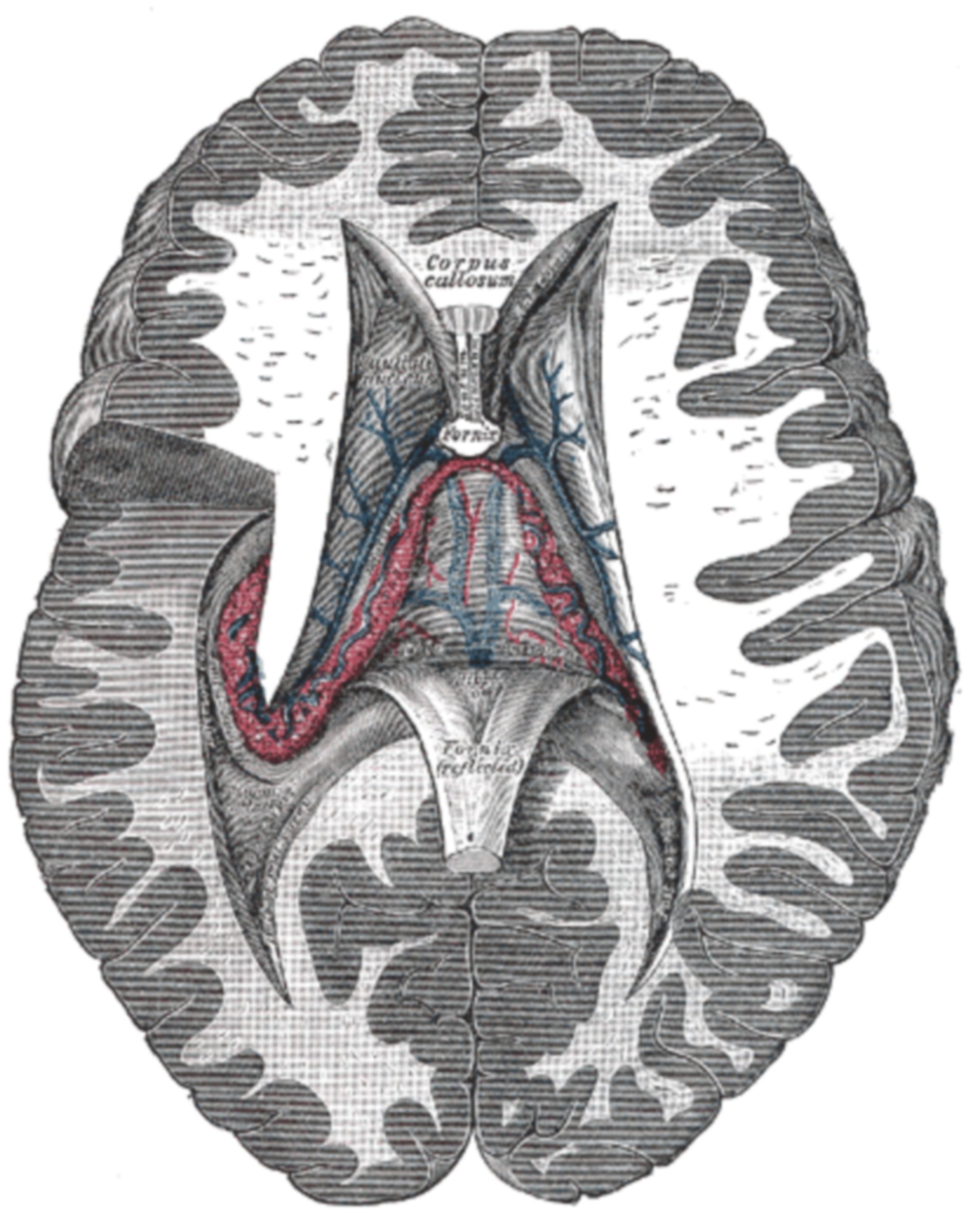 Fig. 750 - Ventrikelsystem mit Plexus choroideus