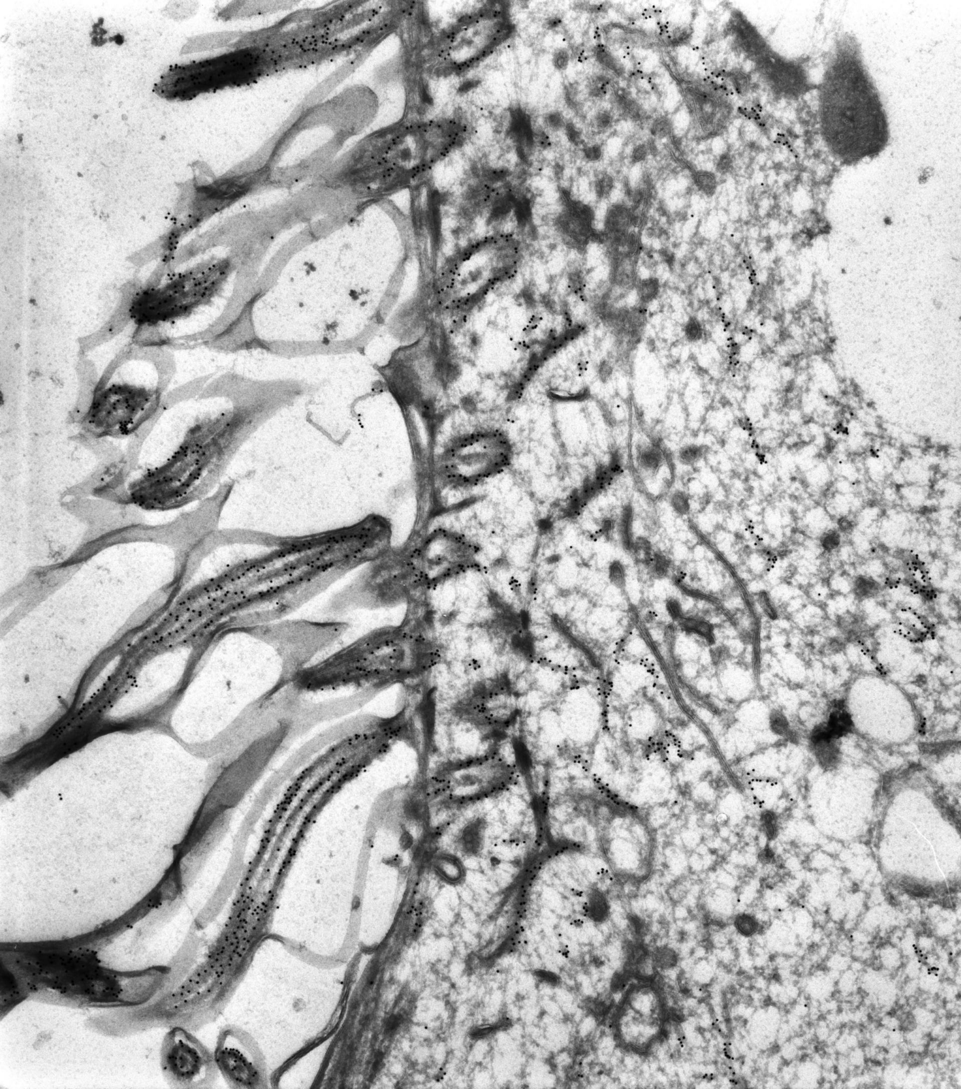 Paramecium tetraurelia (Microtubule basal body) - CIL:38687