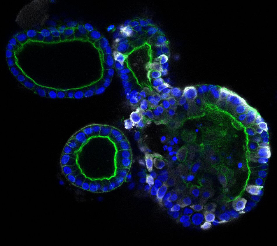 fluorescent-microscopy-1_credit-joep-beu