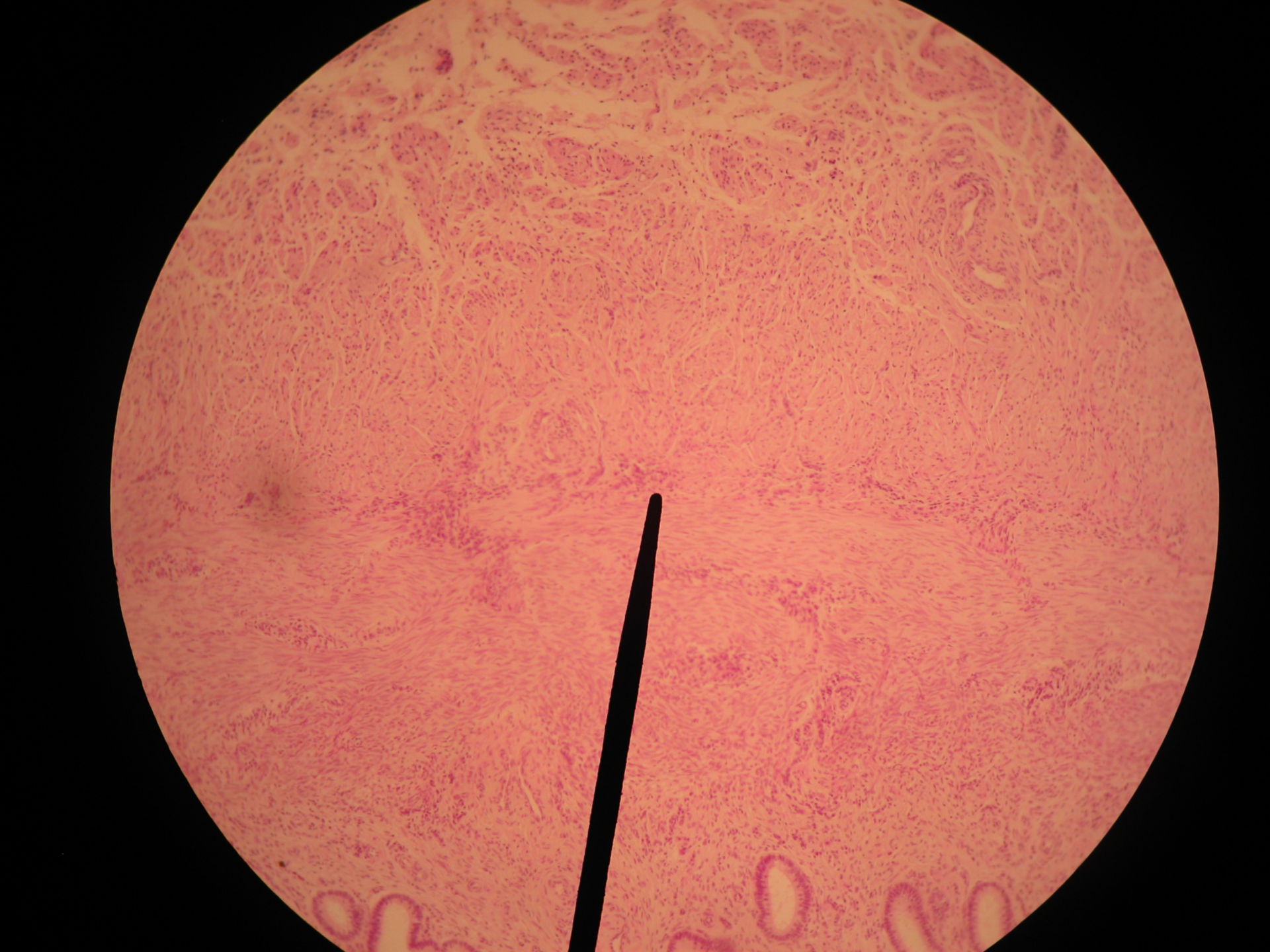 Gebärmutterhals Zibbe (5) - Übergang Stratum circulare zu Stratum longitudinale