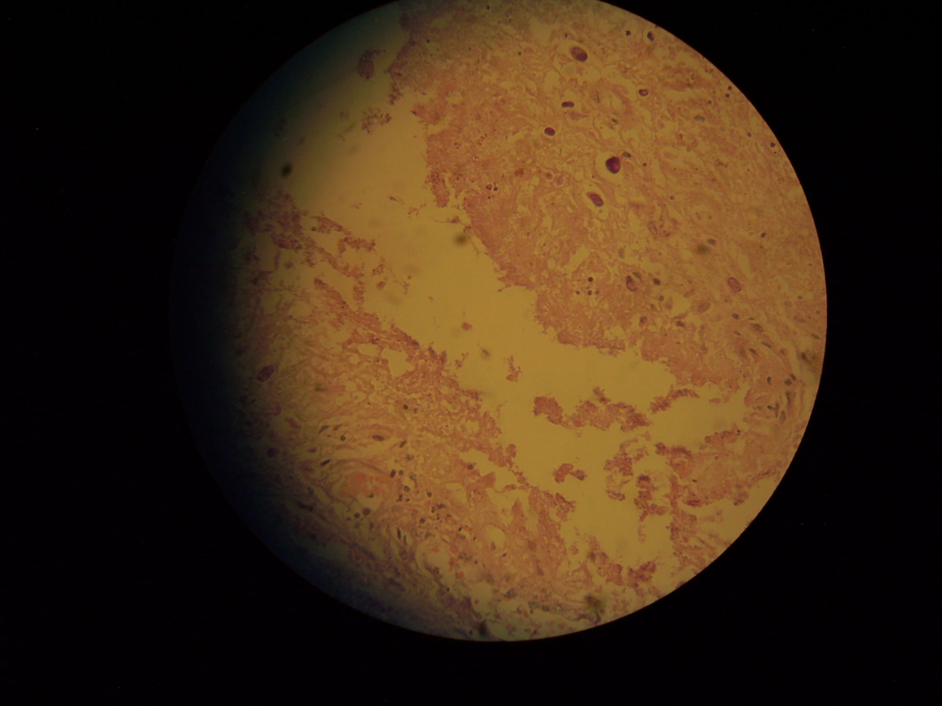 Lichtmikroskopische Aufnahme eines infektiösen Abstriches aus dem Dickdarm