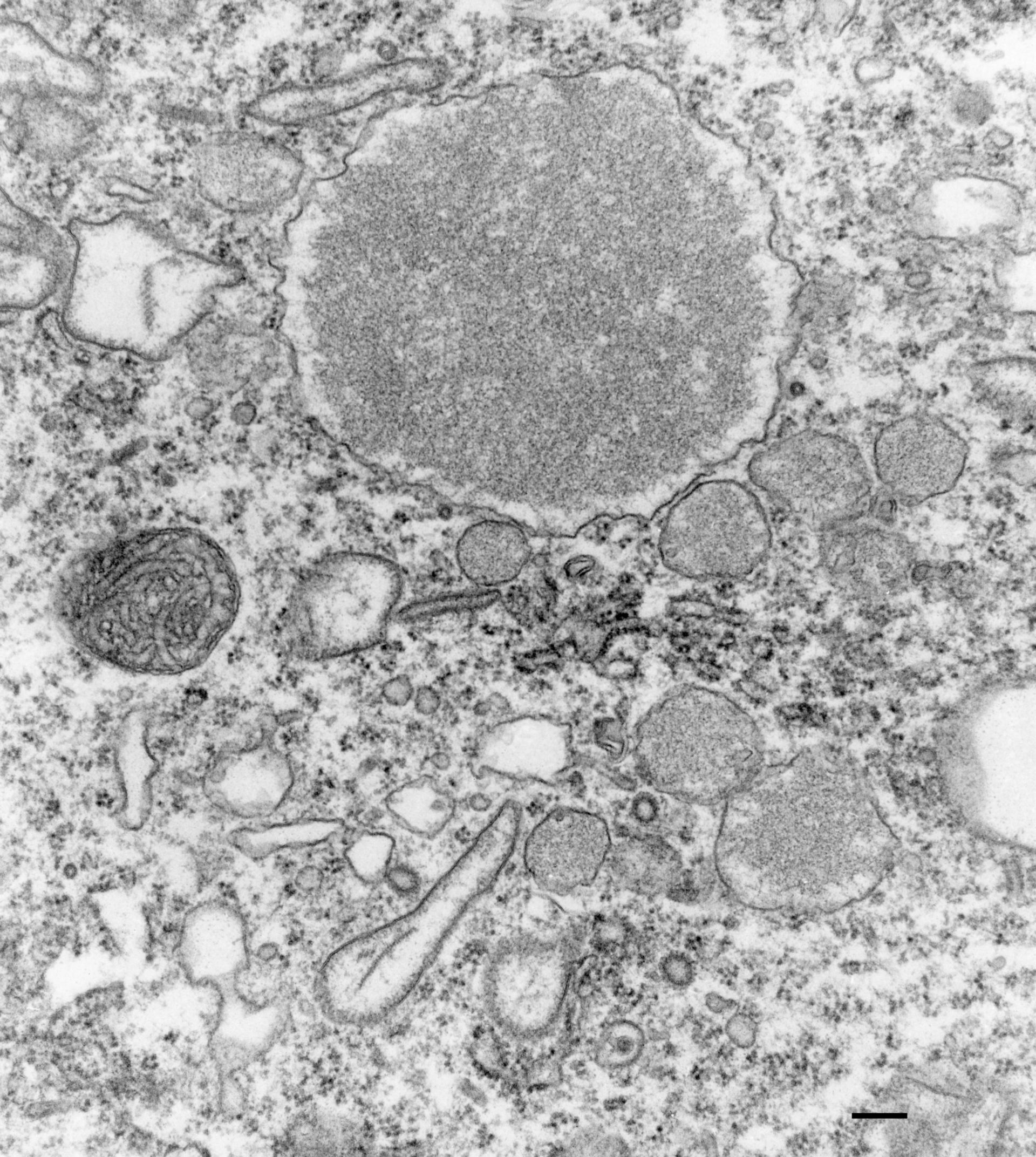 Paramecium multimicronucleatum (Lysosomal membrane) - CIL:36671 - DocCheck