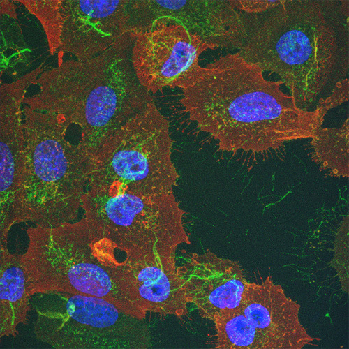 Mit Influenza-A-Virus infizierte humane Lungenkarzinomzellen (Zellkern in blau). Die viralen Proteine Hämagglutinin (grün) und Matrixprotein 2 (rot) befinden sich hauptsächlich an der Plasmamembran. © Zentrum für Mikroskopie und Bildanalyse, Universität Zürich