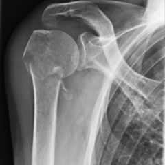 Humerus Doccheck Flexikon