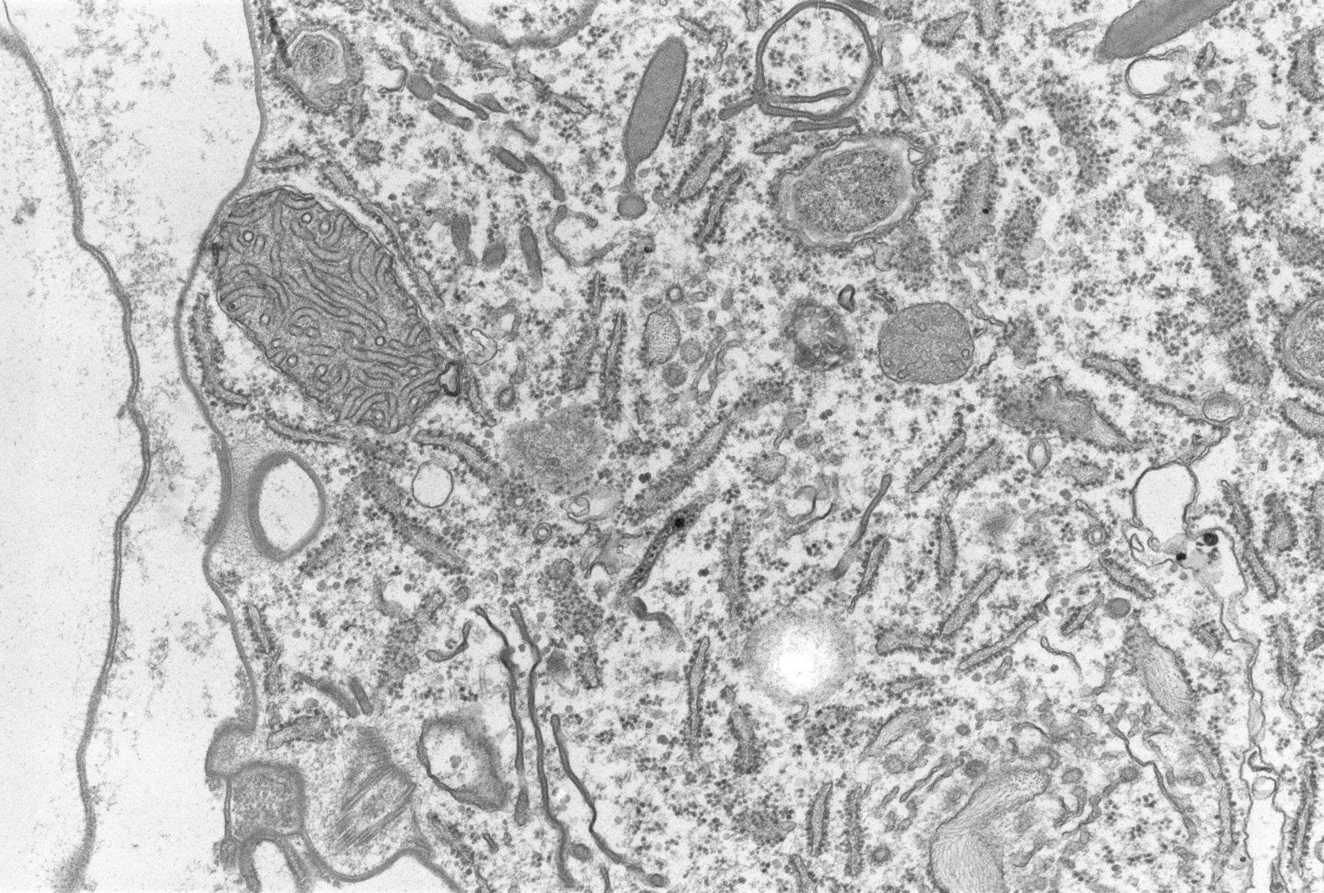 Coleps hirtus (Extrusomes) - CIL:2881