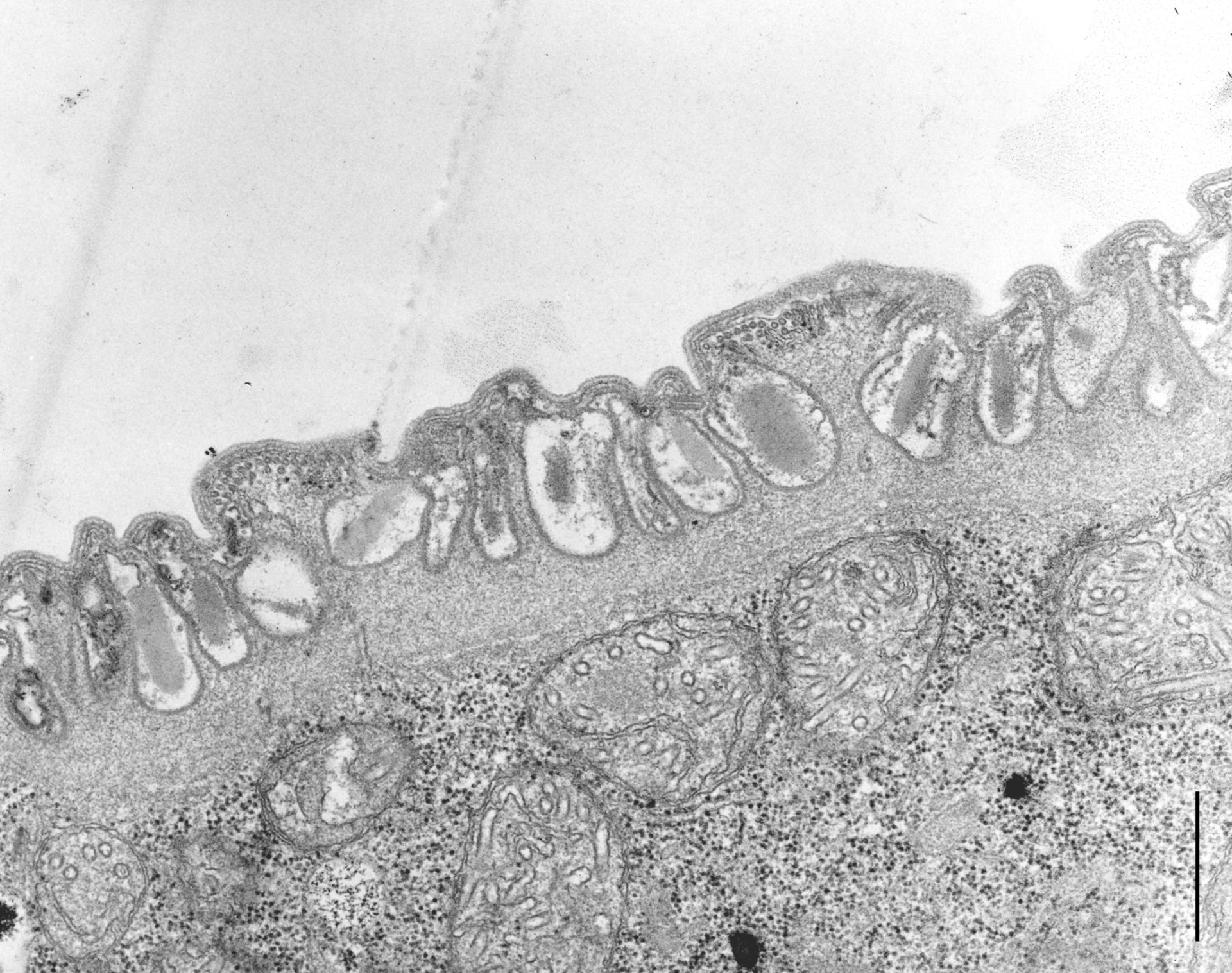 Didinium nasutum (Extrusomes) - CIL:10004