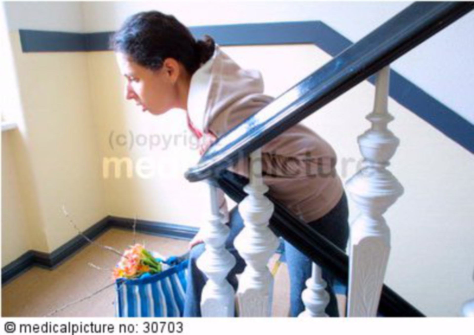 Dyspnea and circulatory problems while climbing stairs