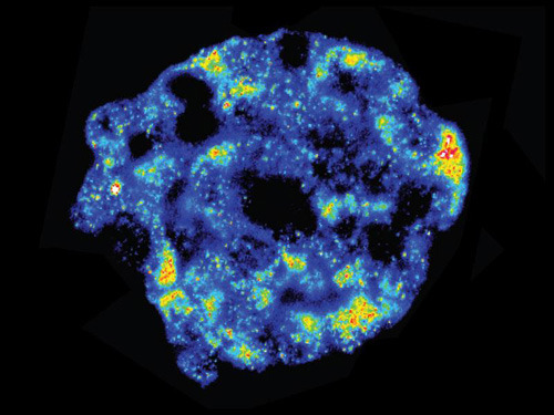 Fluoreszenz-in-situ-Hybridisierung zeigt mRNA-Aktivität. Blau: niedrige, rot: hohe Aktivität. © S. S. Bajikar / University of Virginia, Charlottesville (USA)