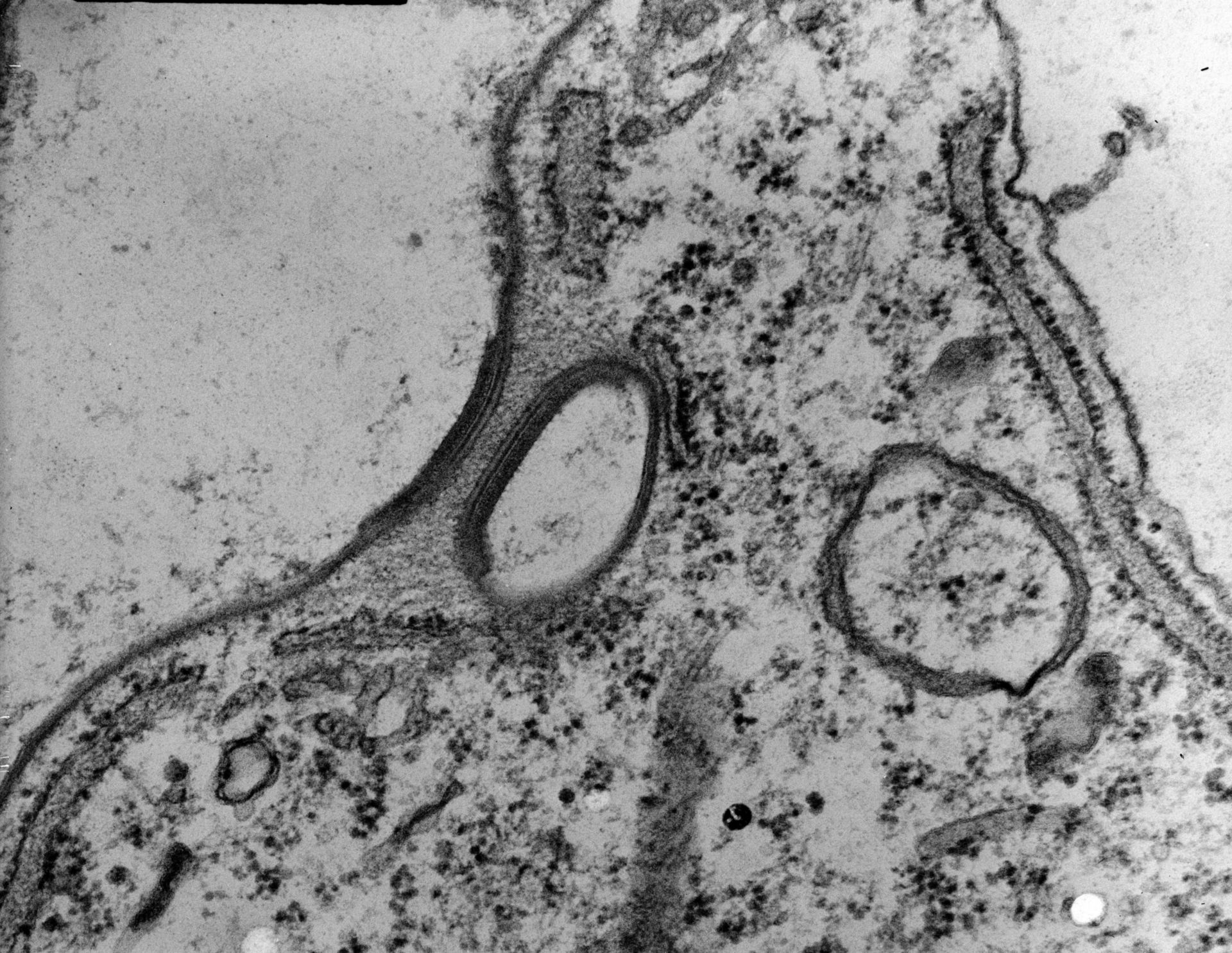 Coleps hirtus (Rough endoplasmic reticulum membrane) - CIL:9254