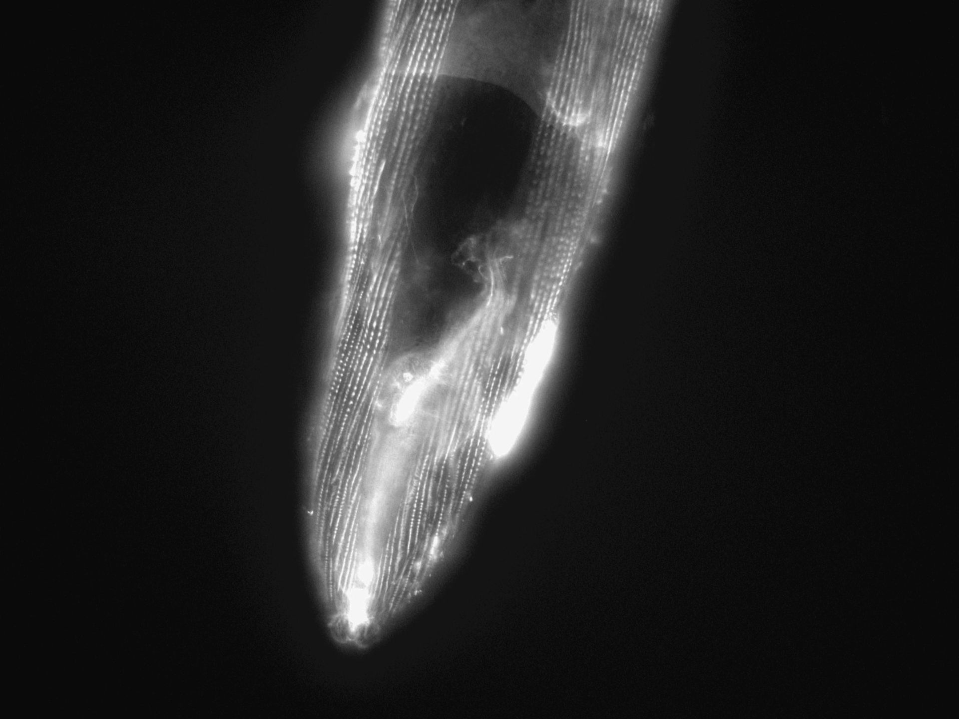 Caenorhabditis elegans (Actin filament) - CIL:1186