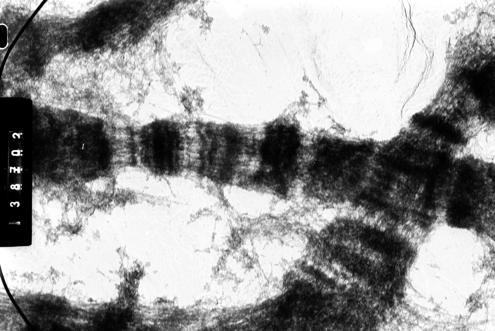 Drosophila melanocephala (Polytene chromosome) - CIL:35400