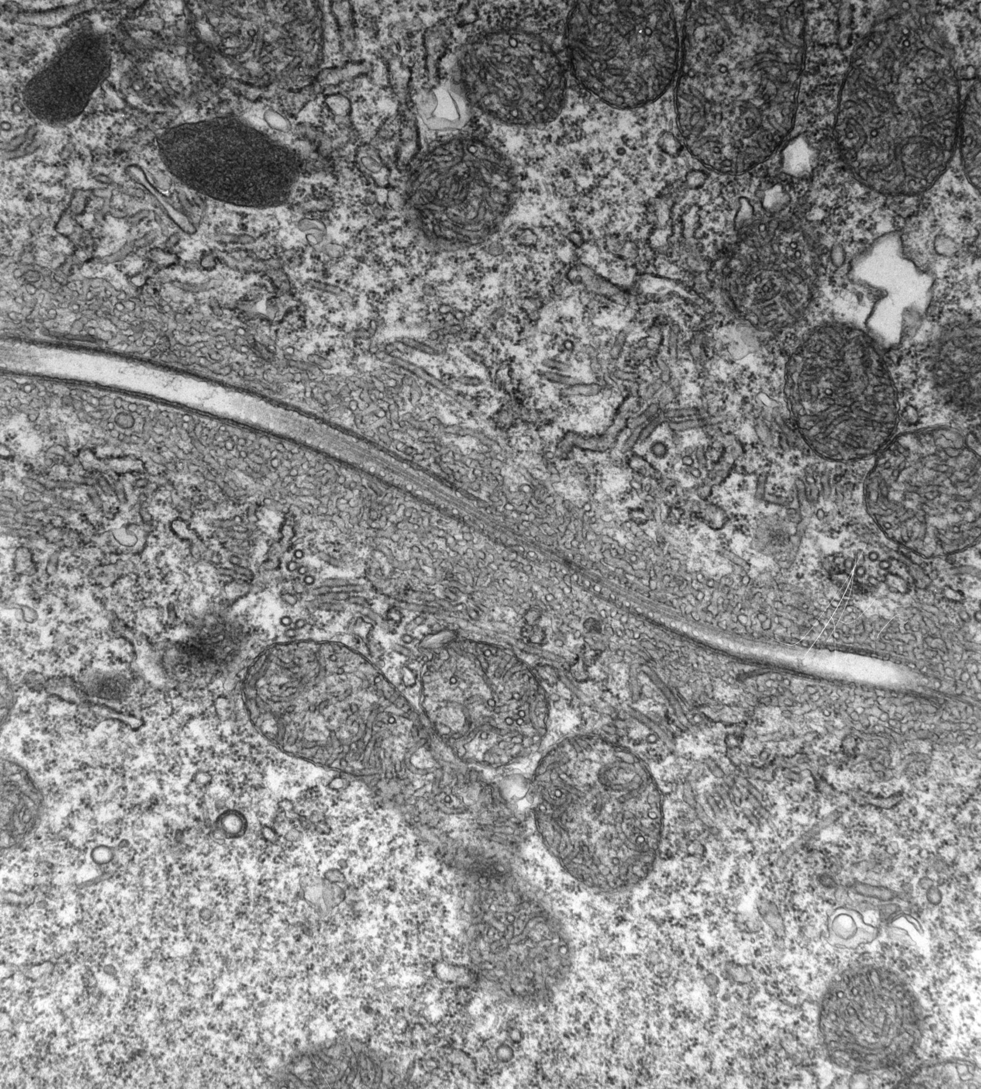 Paramecium multimicronucleatum (Cytoplasm) - CIL:13101