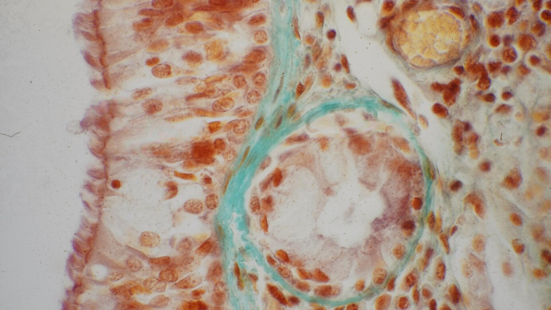 Nasenmuschel (Histologie)