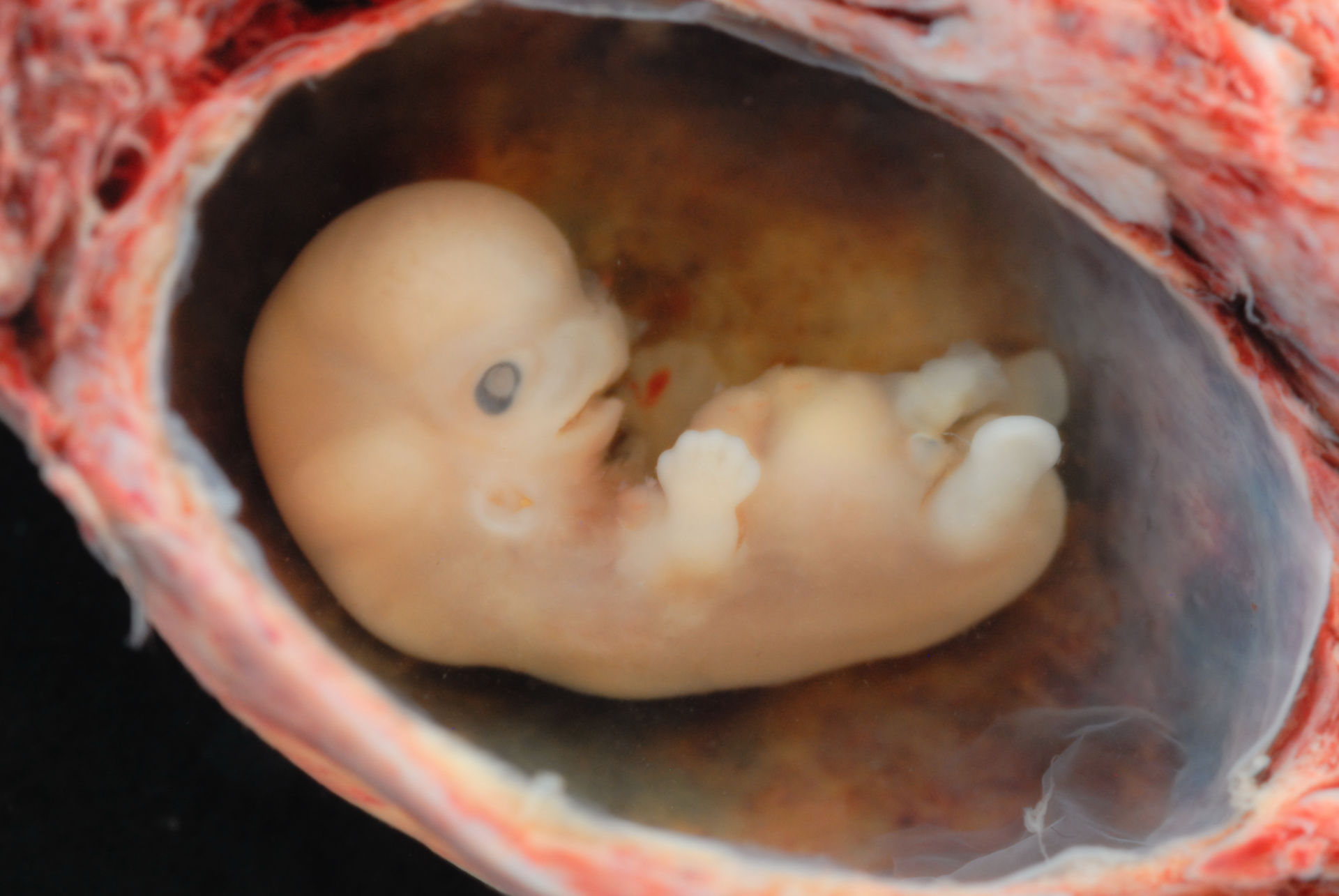 Embyro (6 weeks estimated gestational age)