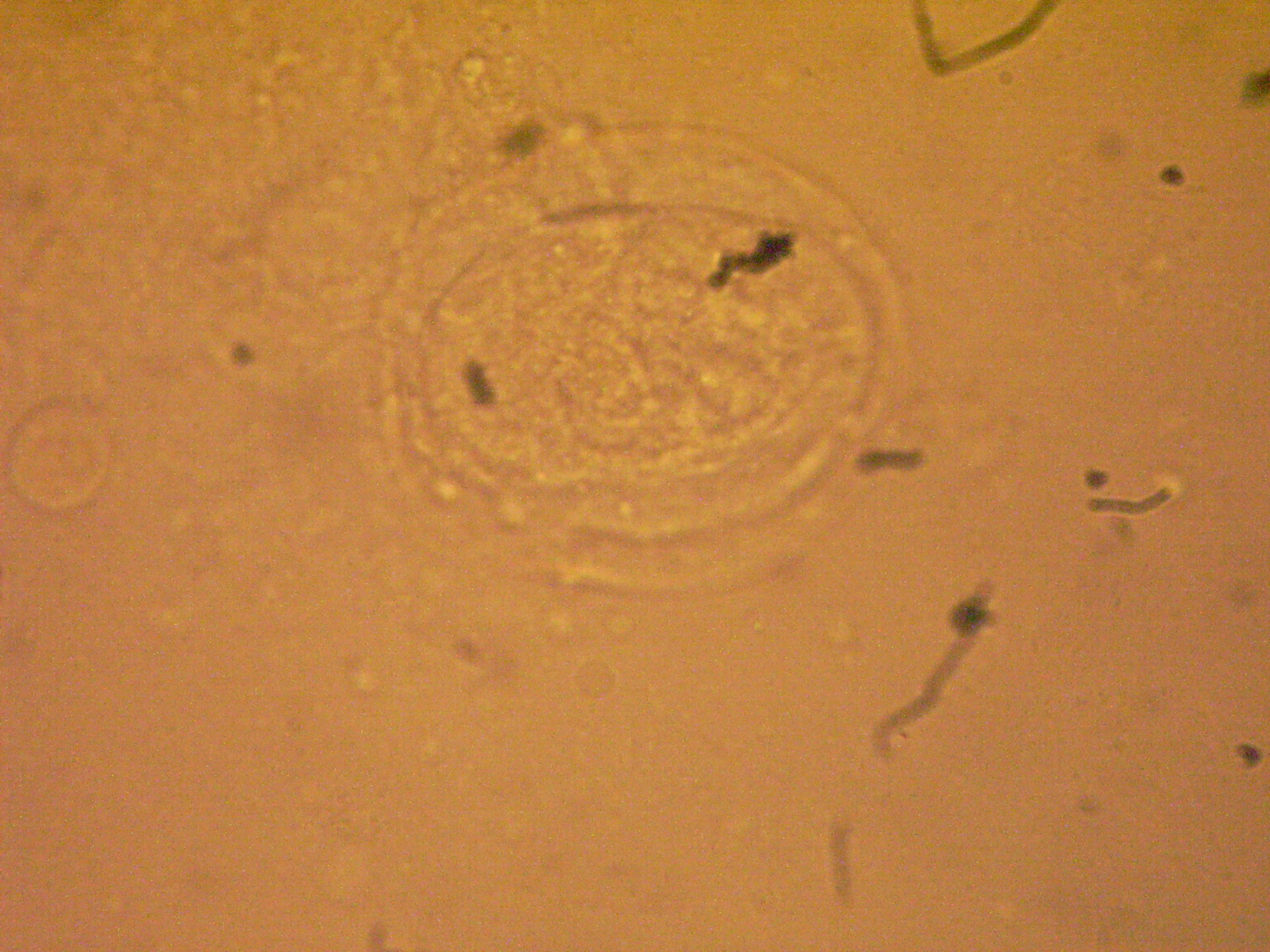 Schistosoma japonicum.JPG