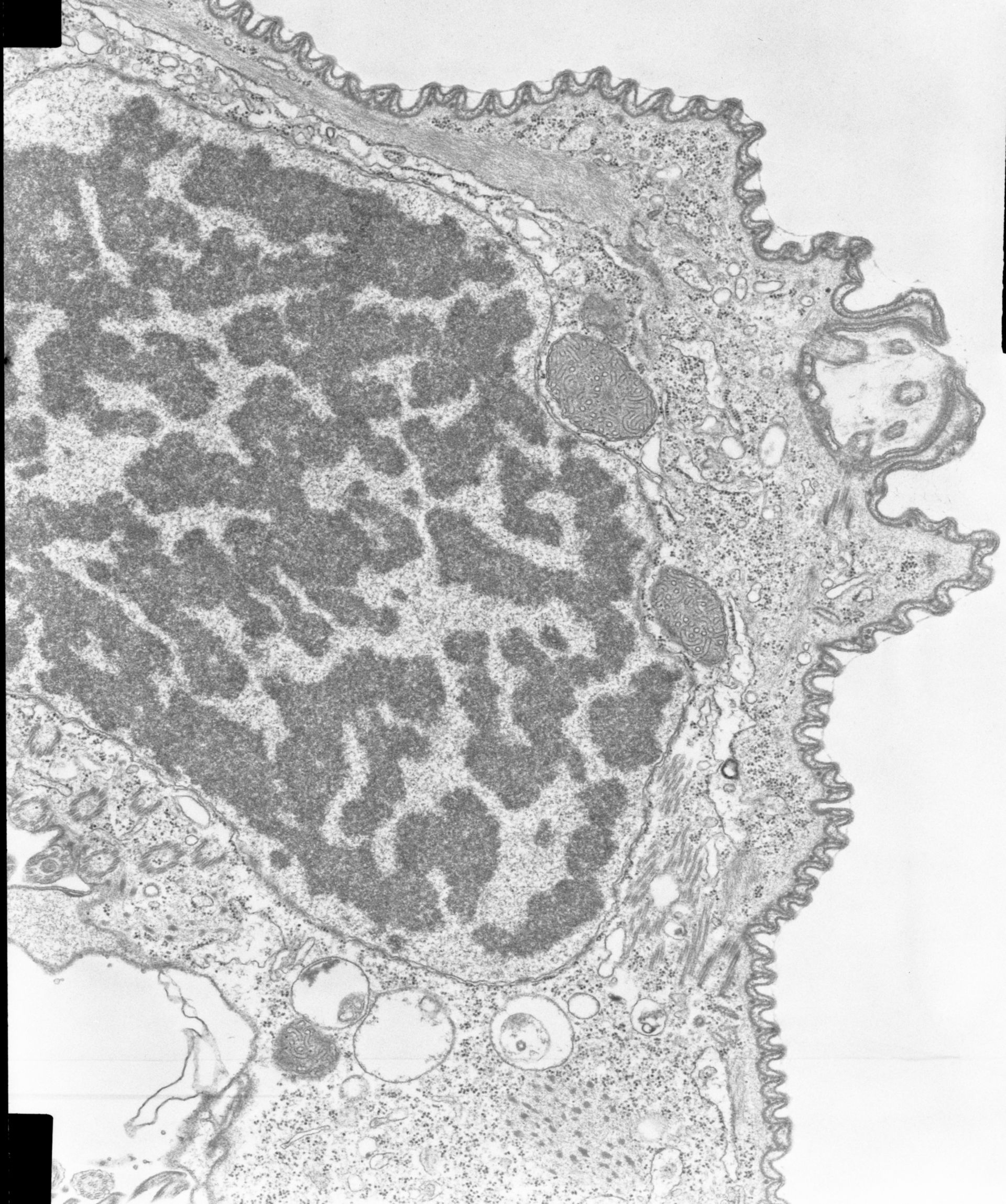Opercularia coarctata (corpo basale microtubuli) - CIL:7333