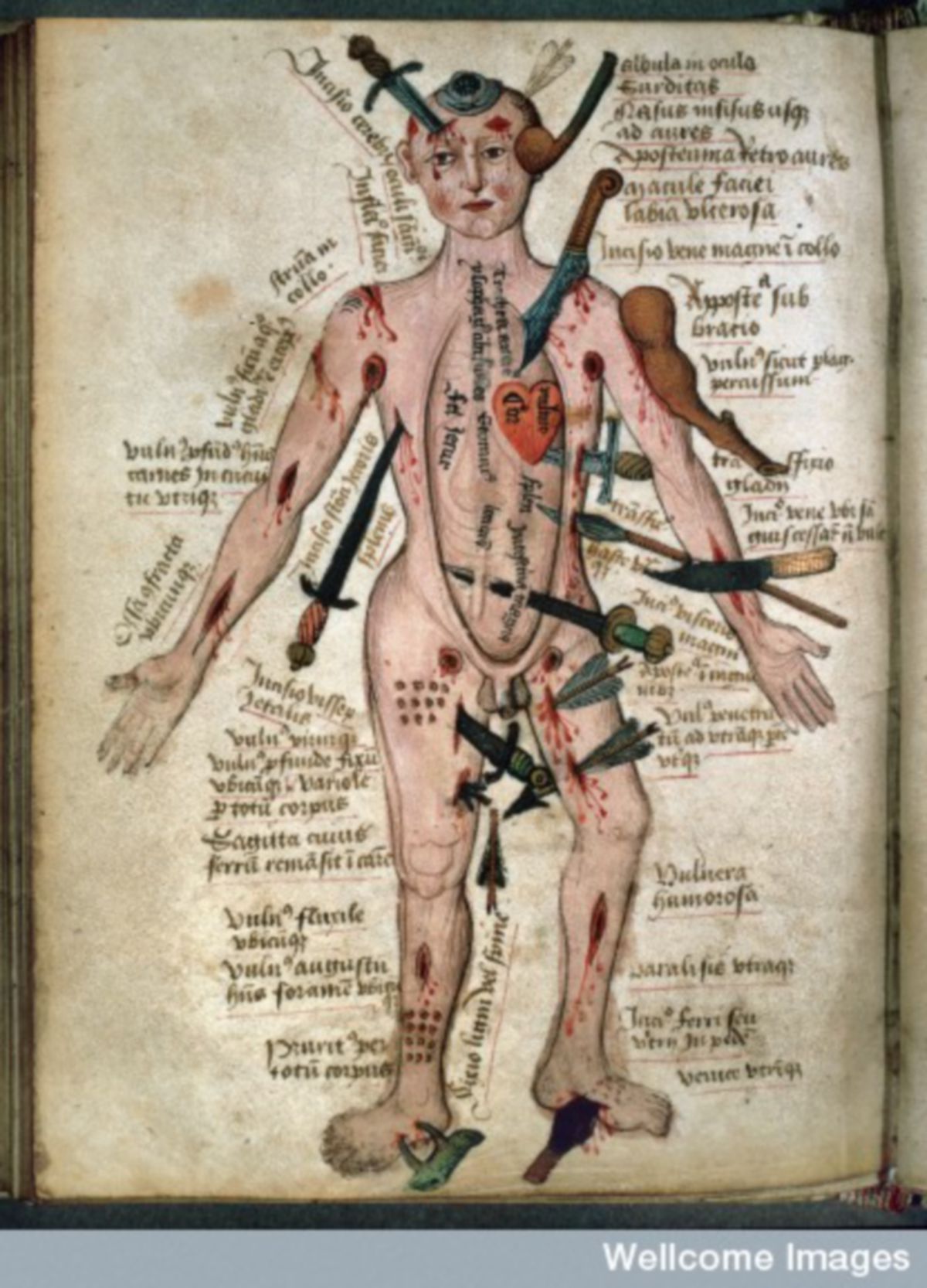 Wundenmann, aus: Pseudo-Galen, Anatomia