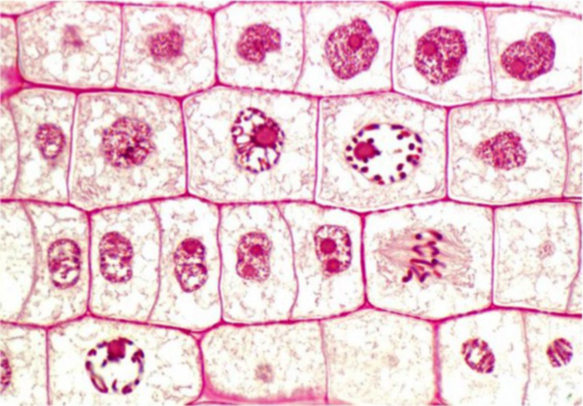 Mitose in Zwiebelzellen