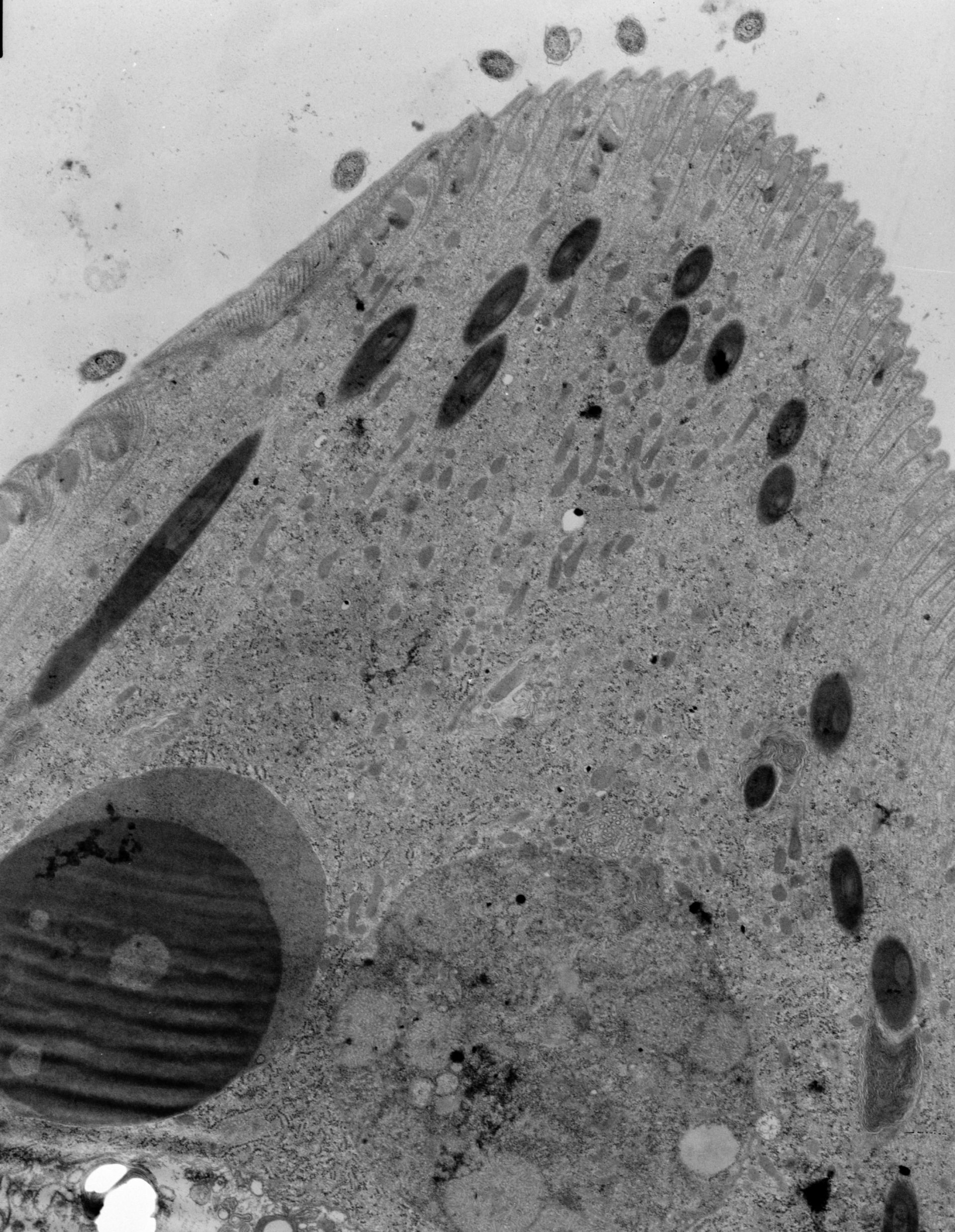 Didinium nasutum (Toxic extrusomes) - CIL:38863