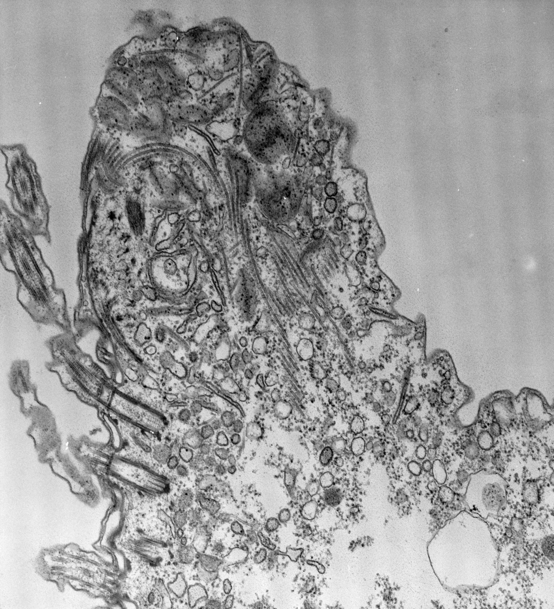 Paramecium caudatum (Pre-autophagosomal structure) - CIL:39165