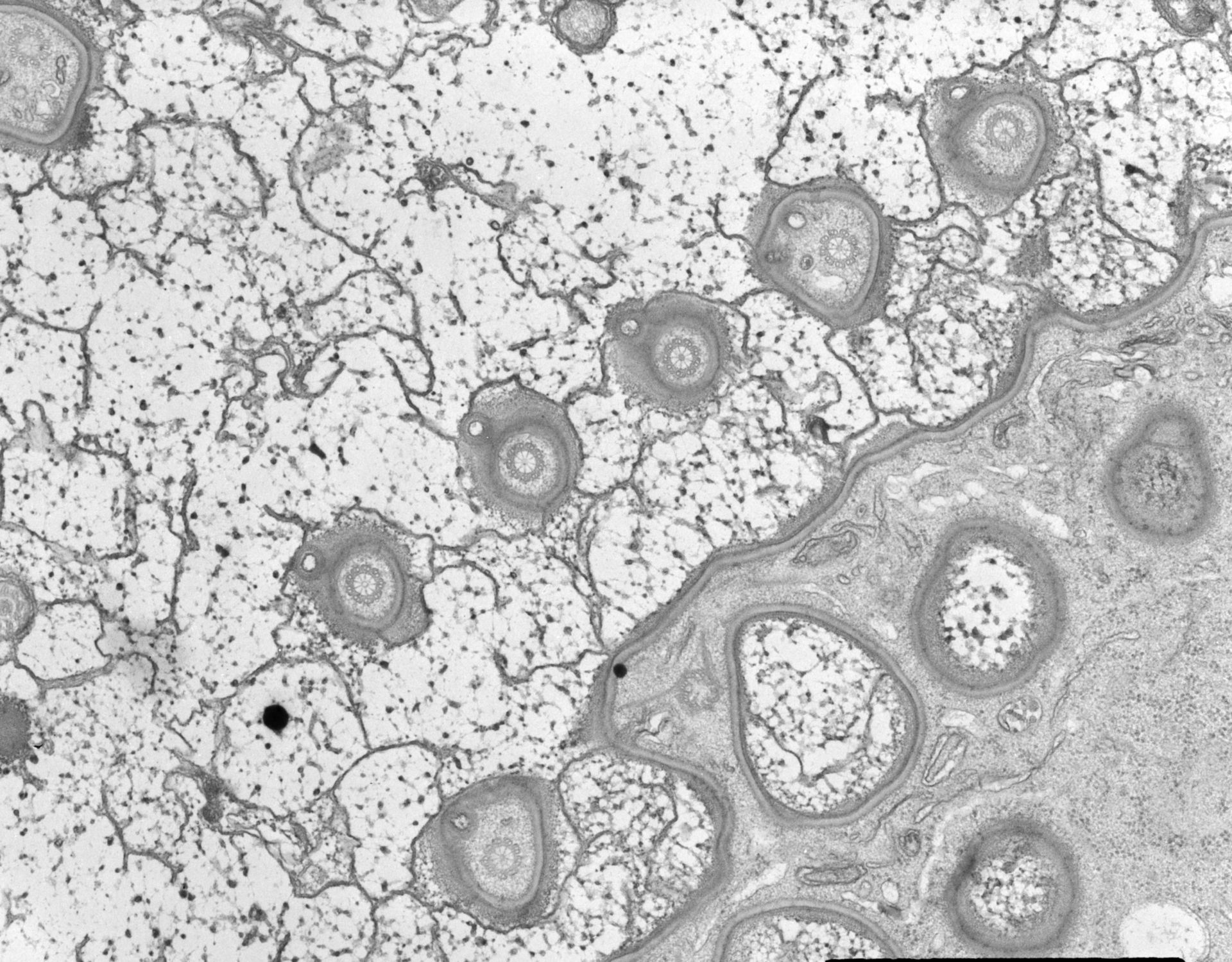 Nassula (Absence of cilia) - CIL:7747
