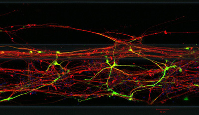 Nervenzellen, die aus Hautzellen hergestellt wurden, bilden ein dreidimensionales Netzwerk auf dem Chip. © Edinson Lucumi Moreno, LCSB