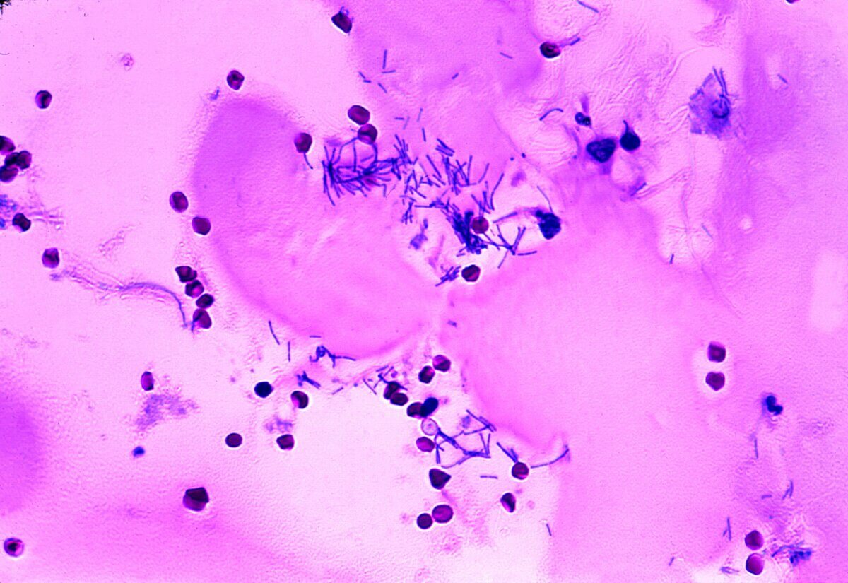 Bacillus anthracis