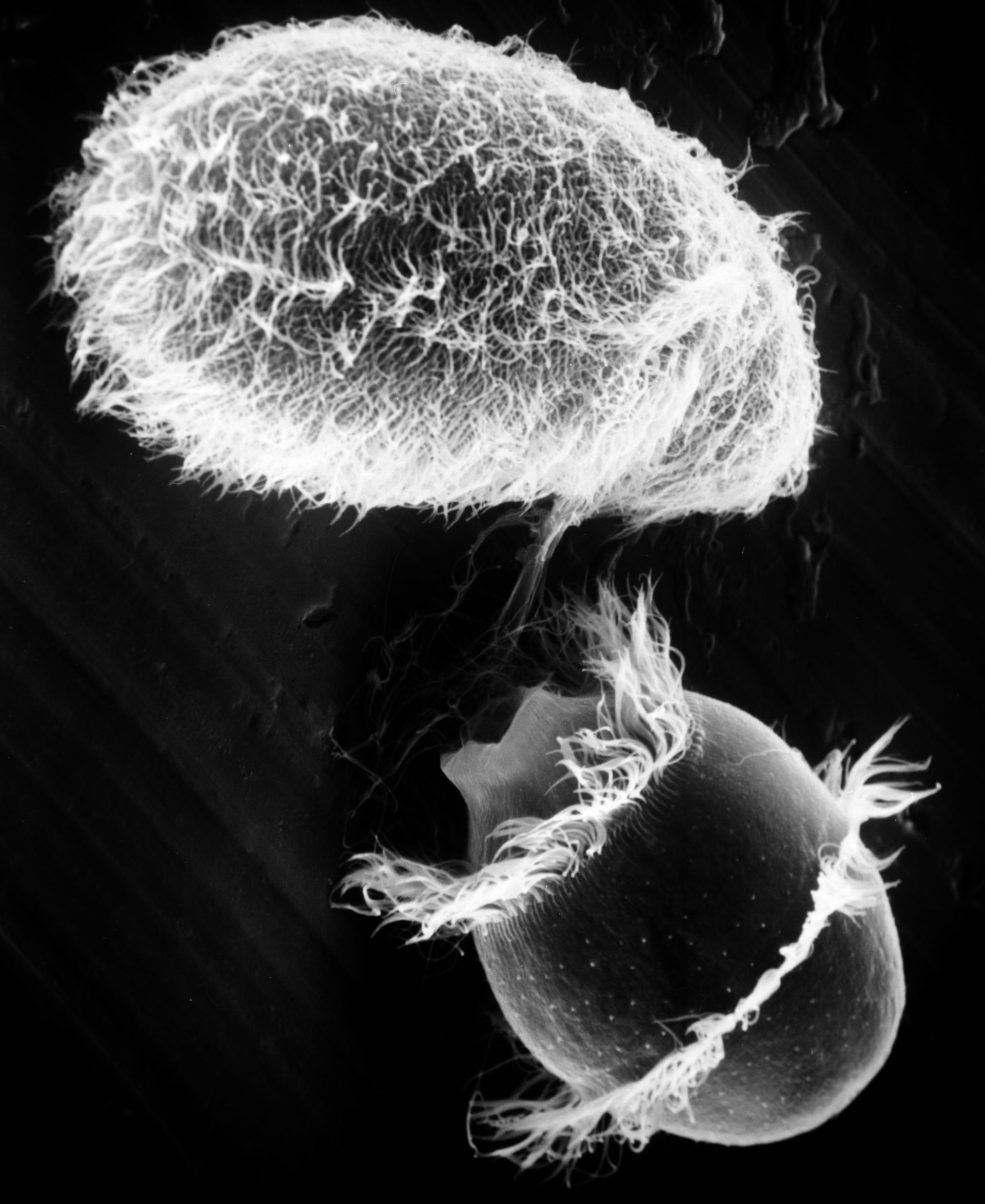 Paramecium sp. (Cell surface) - CIL:40951