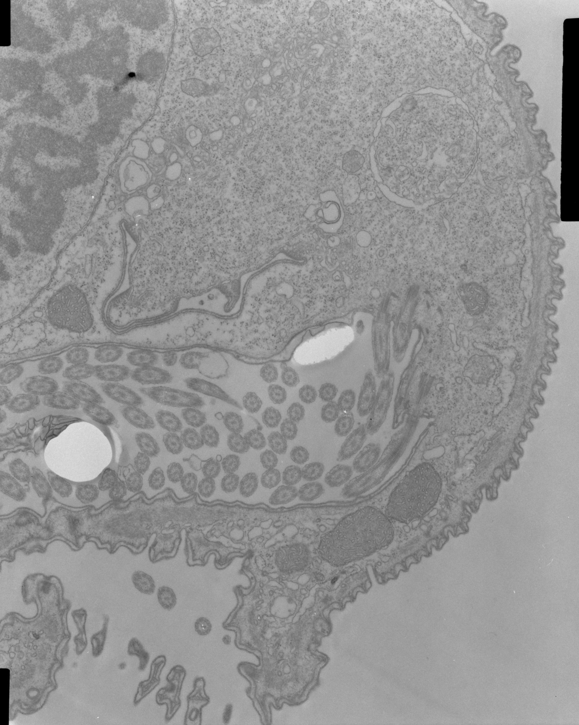 Opercularia coarctata (Cytoplasm) - CIL:39335