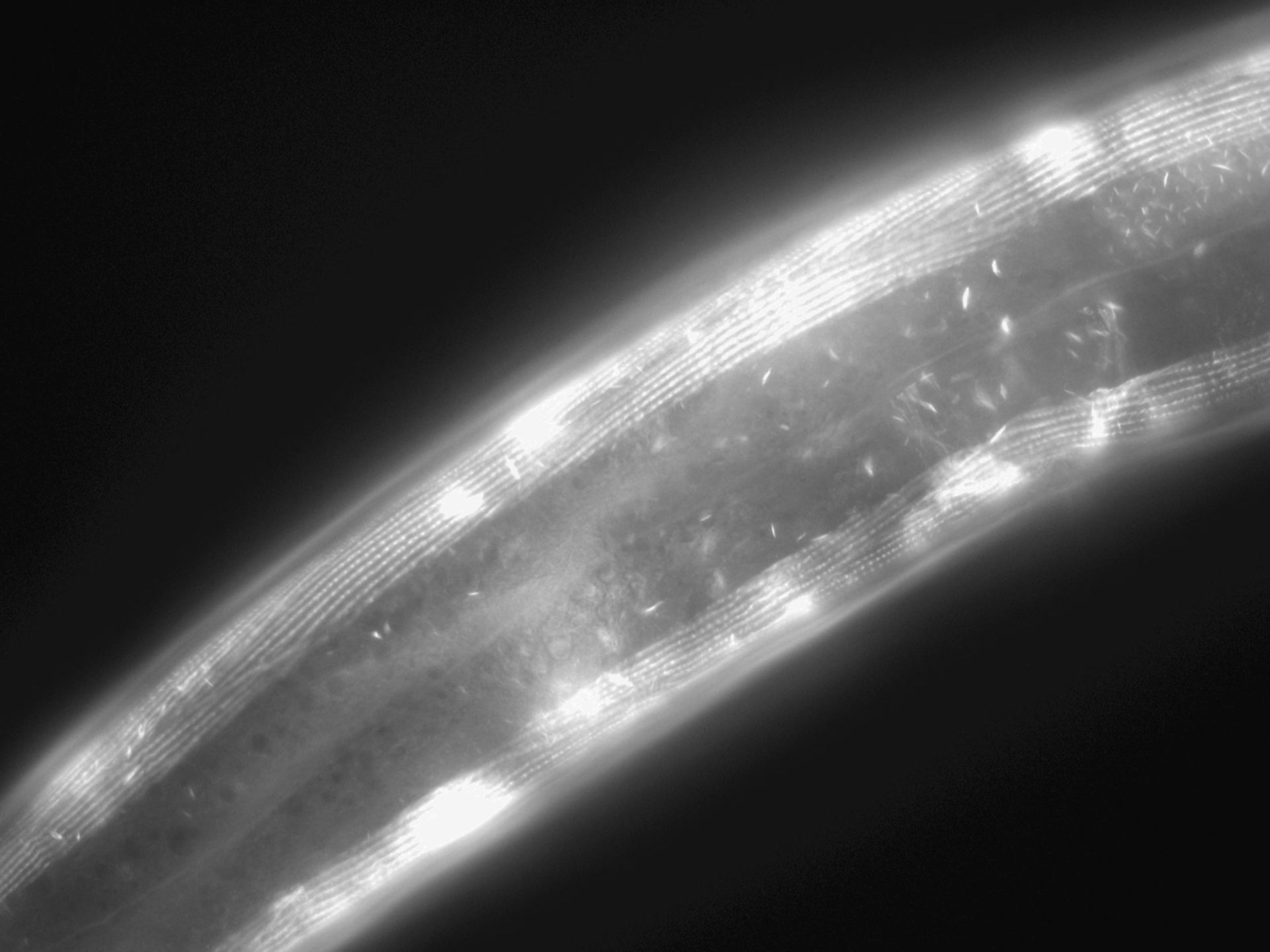 Caenorhabditis elegans (Actin filament) - CIL:1038