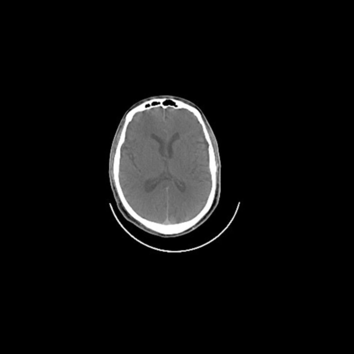 CT: brain - DocCheck