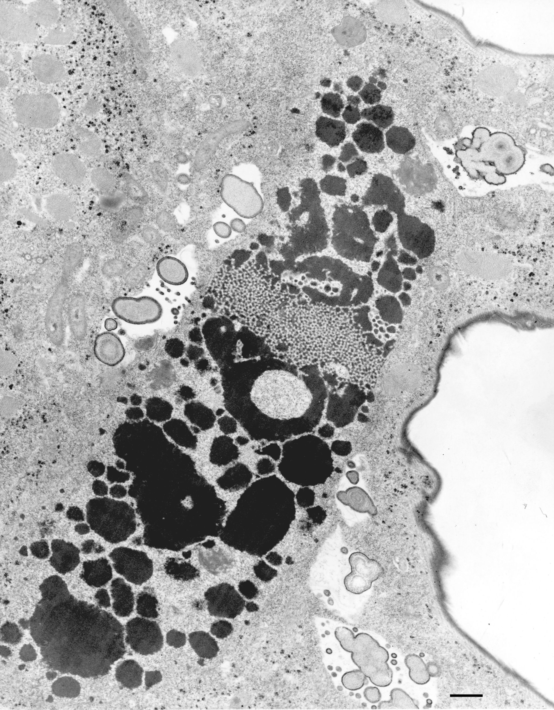 Euplotes sp. (Contractile vacuole) - CIL:12334