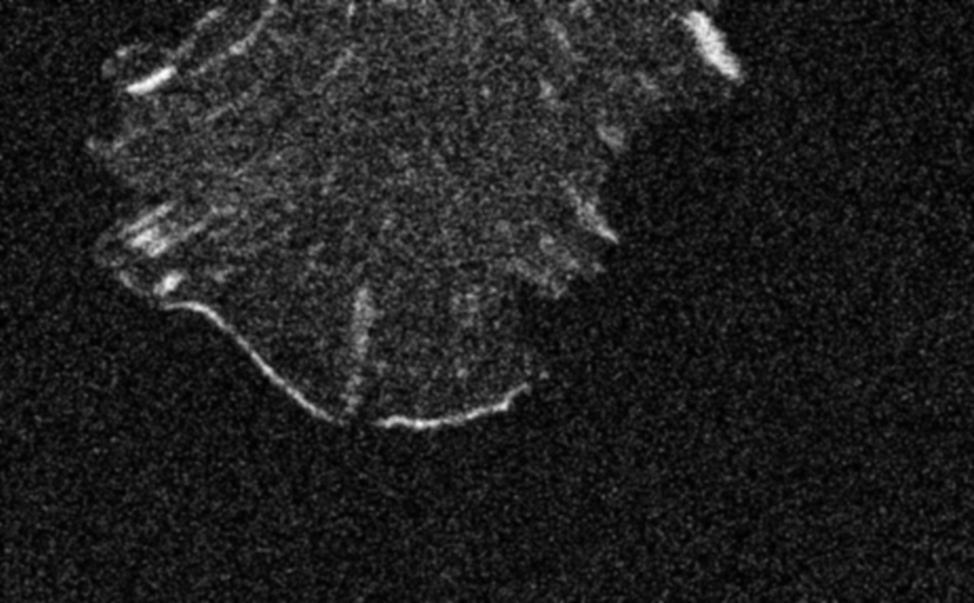 Mus musculus (Cytoskeleton) - CIL:132