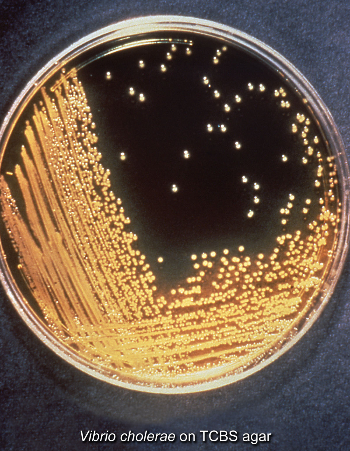 Cholera-Bakterien (Vibrio cholerae auf TCBS-Agar)