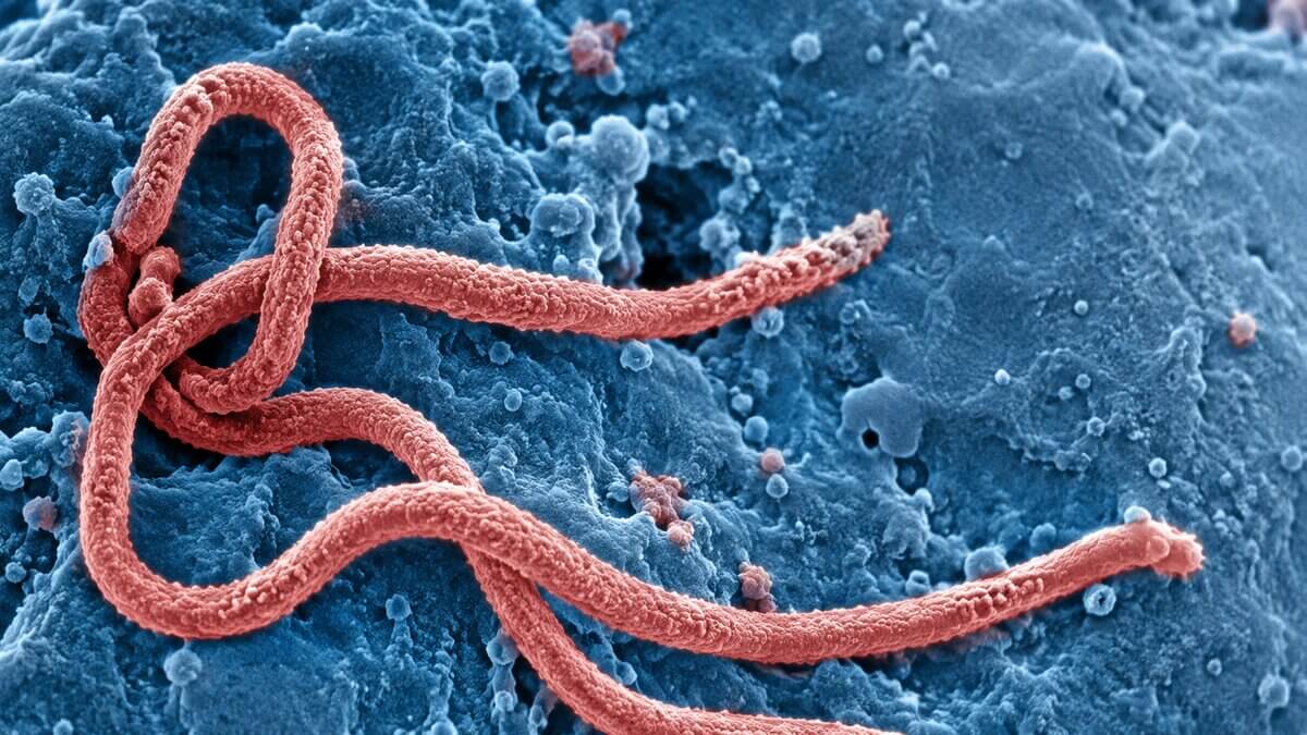 Ebolavirus