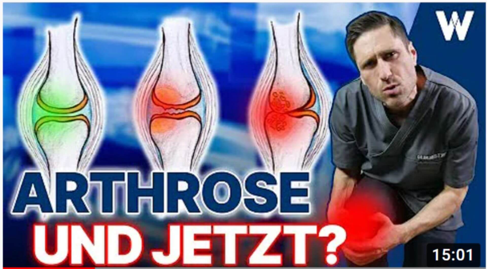 Arthrose: Machen Sie Nicht Die Typischen Fehler - Es Sind Ihre Gelenke ...