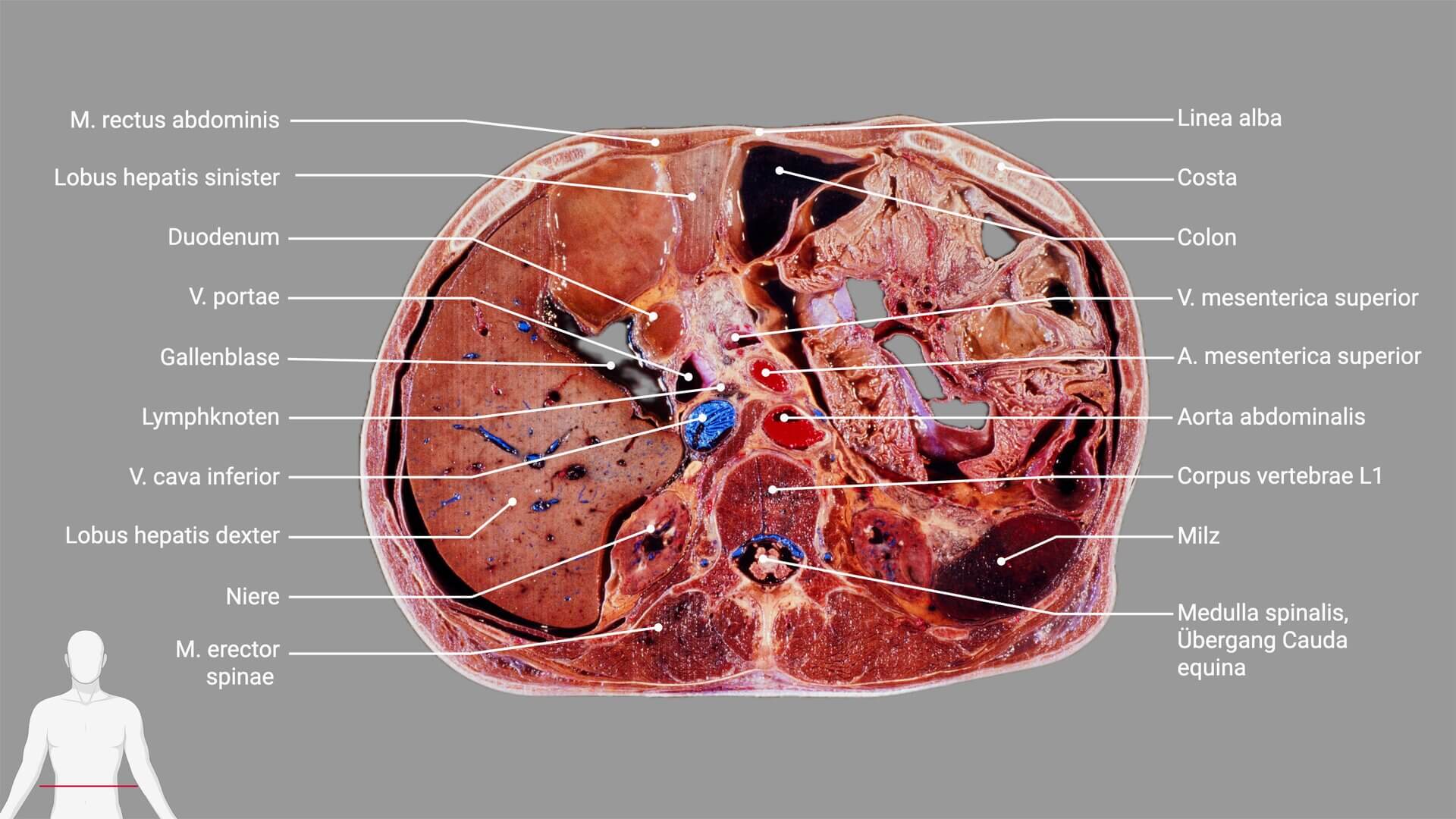 Körperschnittpräparat mit Beschriftung